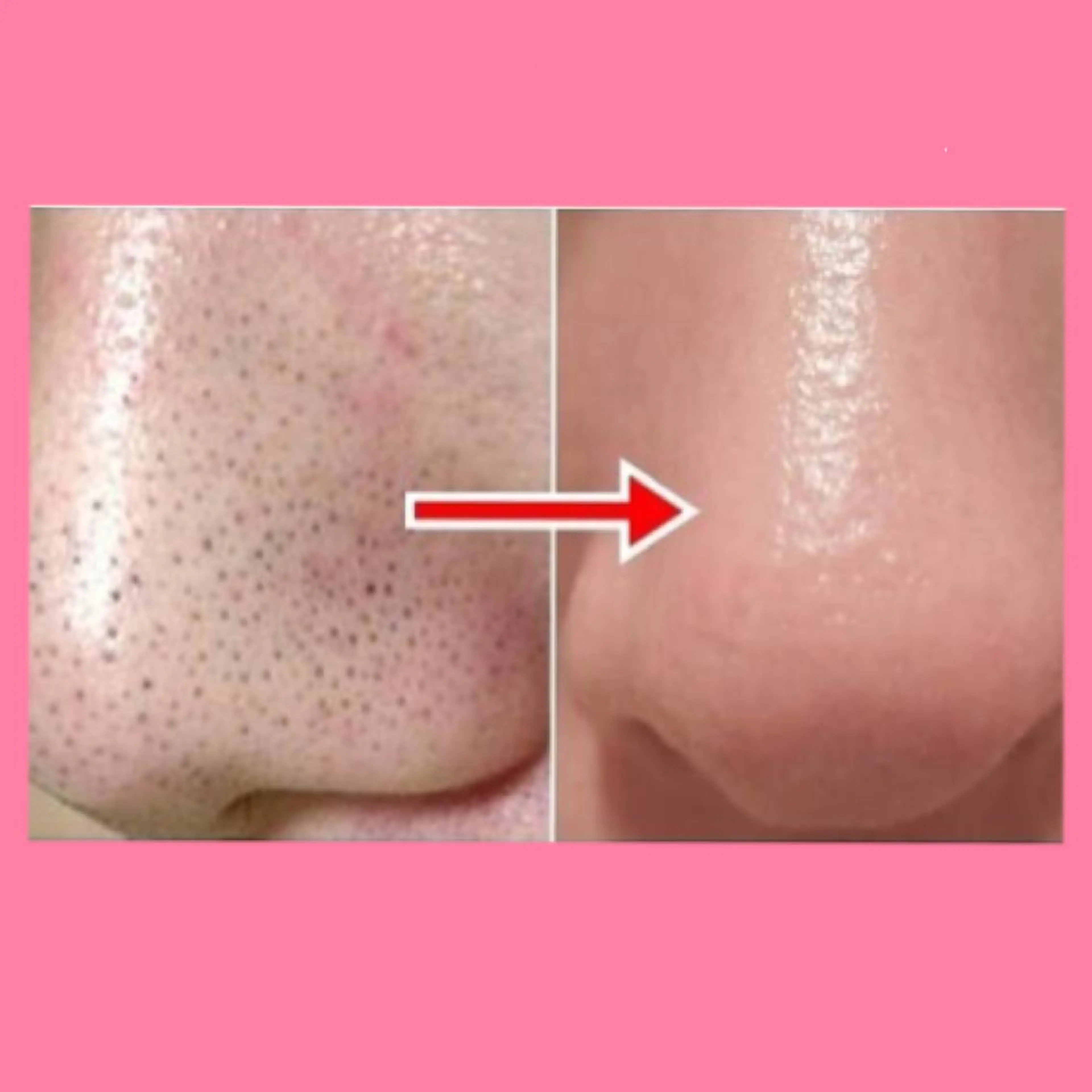 肌ケア＆毛穴洗浄 Cheri/女性専用のエステ・リラクイメージ