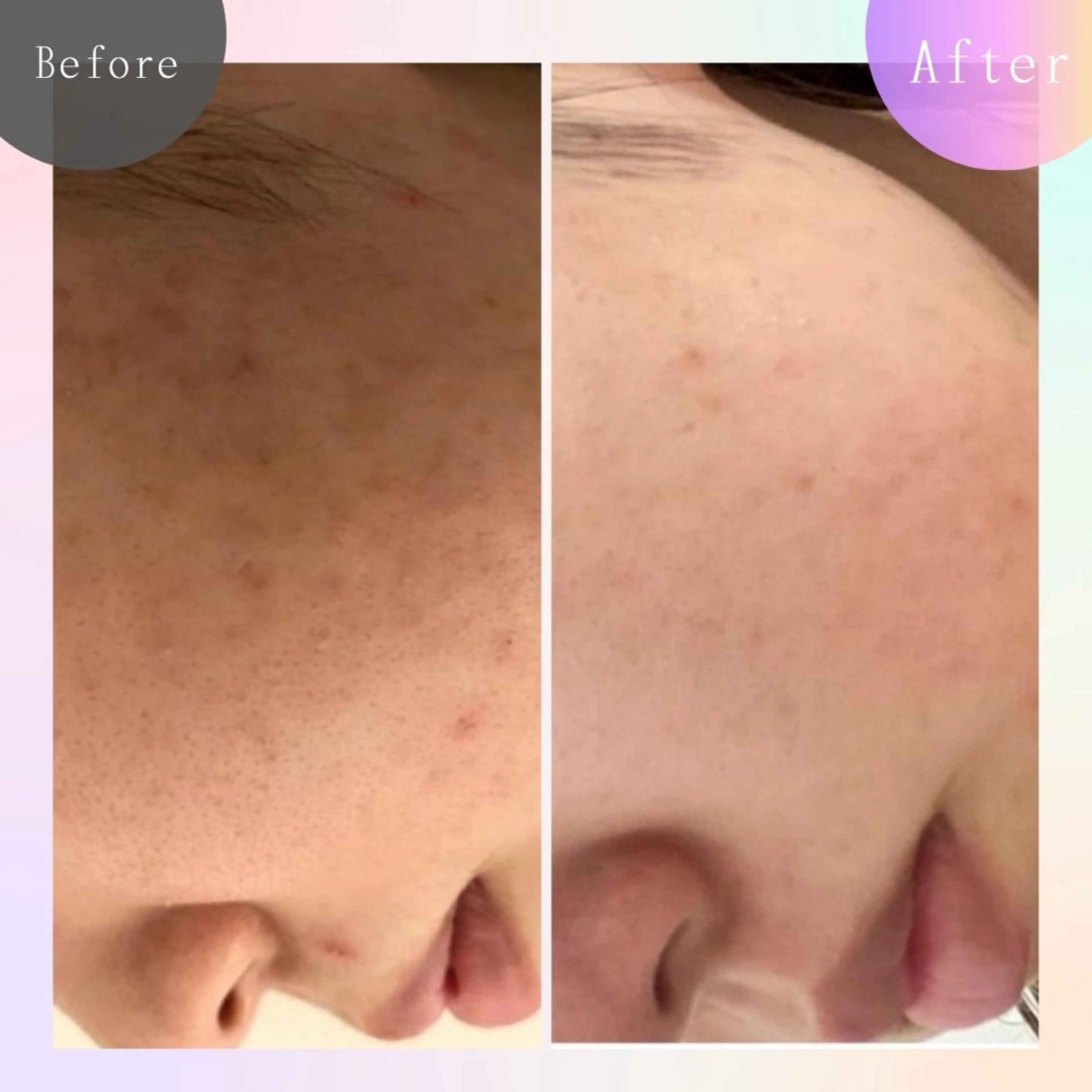 毛穴改善サロン d'Alba大阪住吉のエステ・リラクイメージ