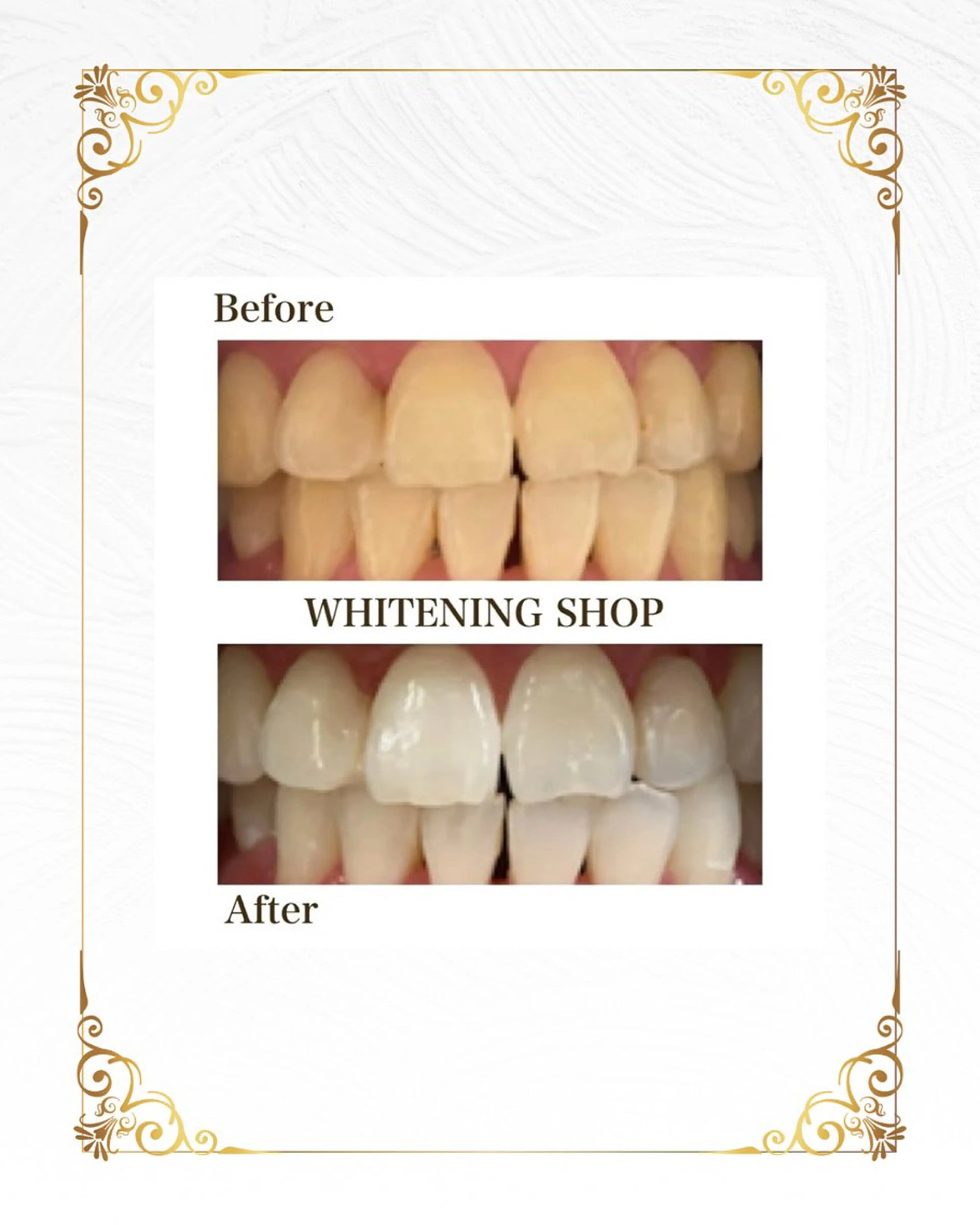 ホワイトニング ショップ葵区静岡駅店のその他イメージ