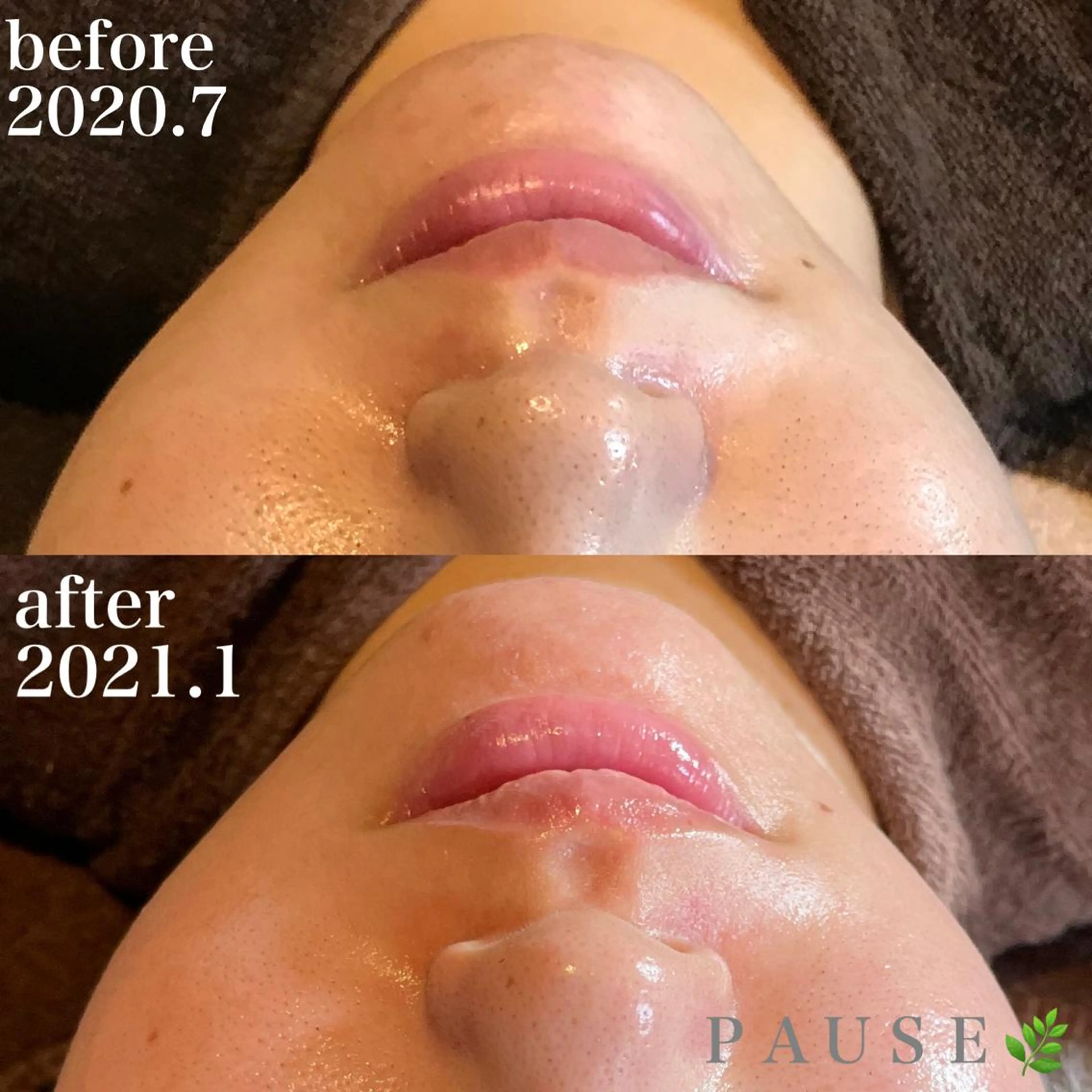 エステ 浜野 恵美のエステ・リラクイメージ