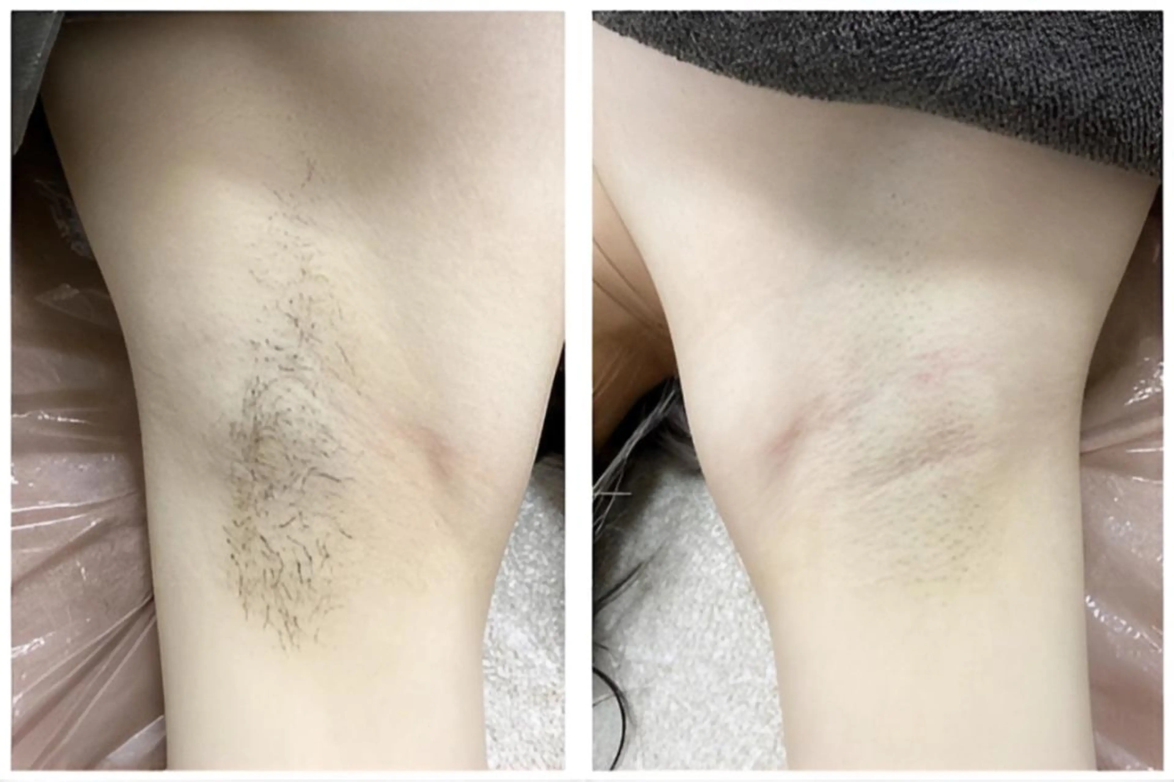 ize 横浜店のエステ・リラクイメージ