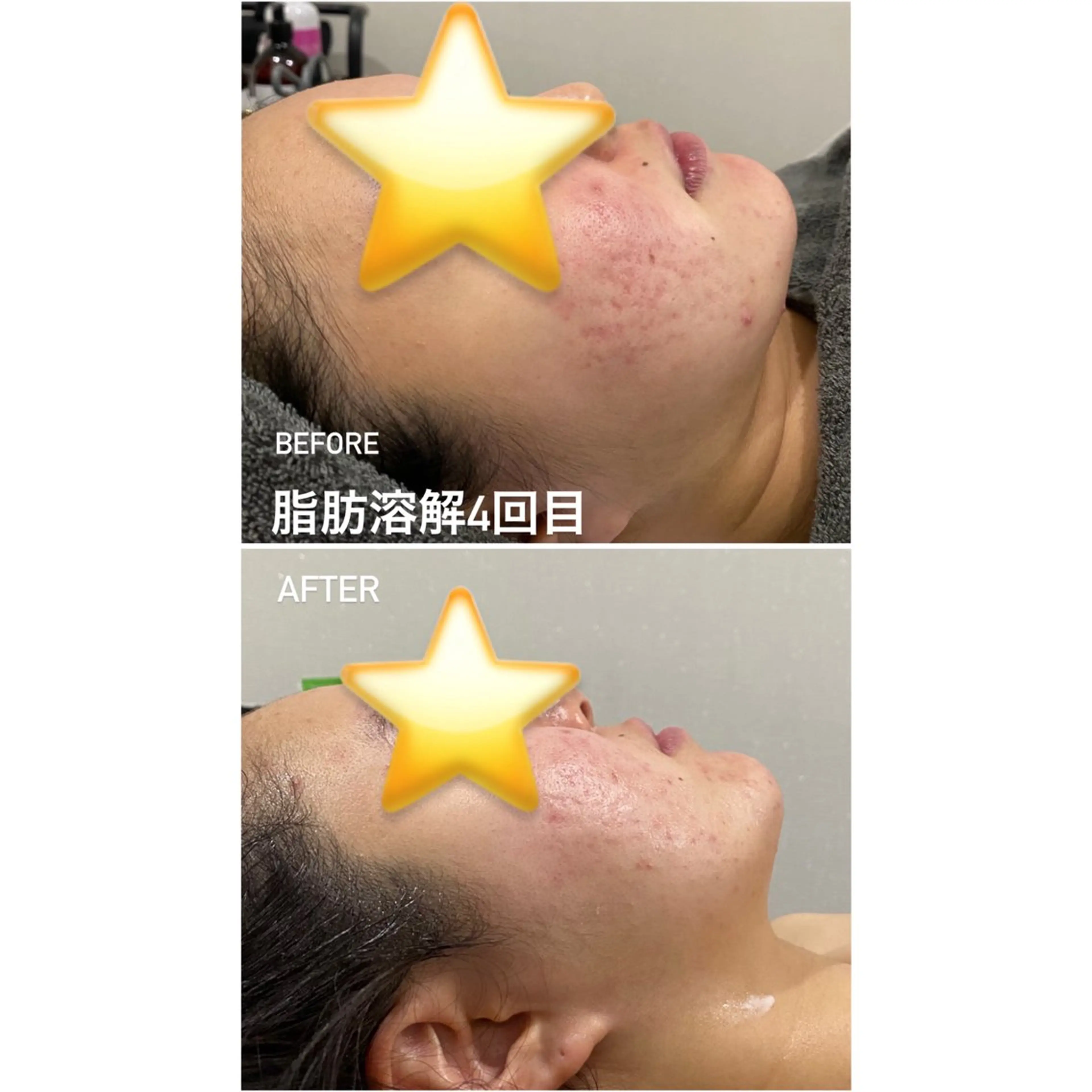 エステ 毛穴洗浄・痩身・脱毛 /アルカンジュのエステ・リラクイメージ