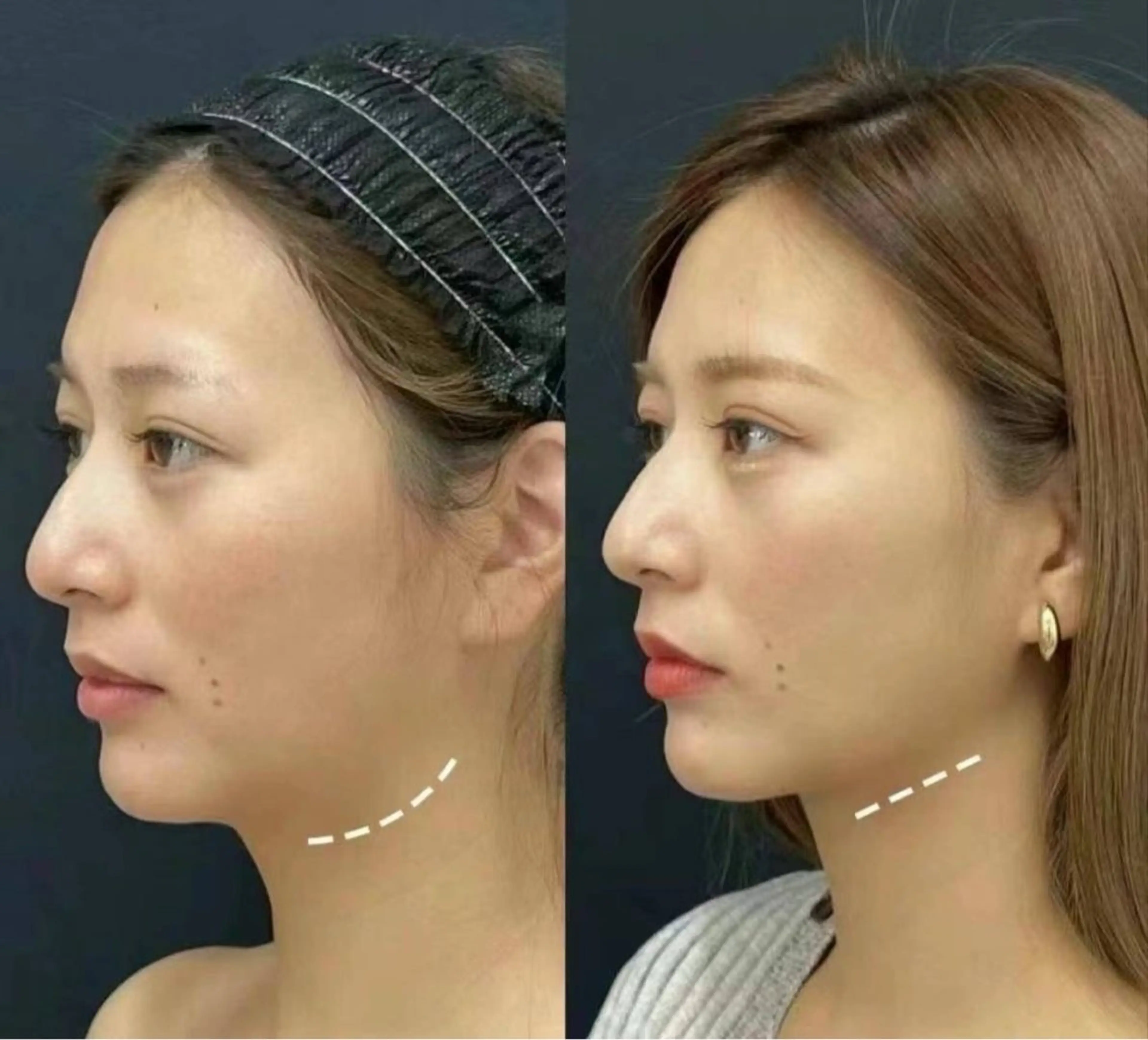 ネイル エステ aliaハーブ水光店 エステティシャン募集のエステ・リラクイメージ