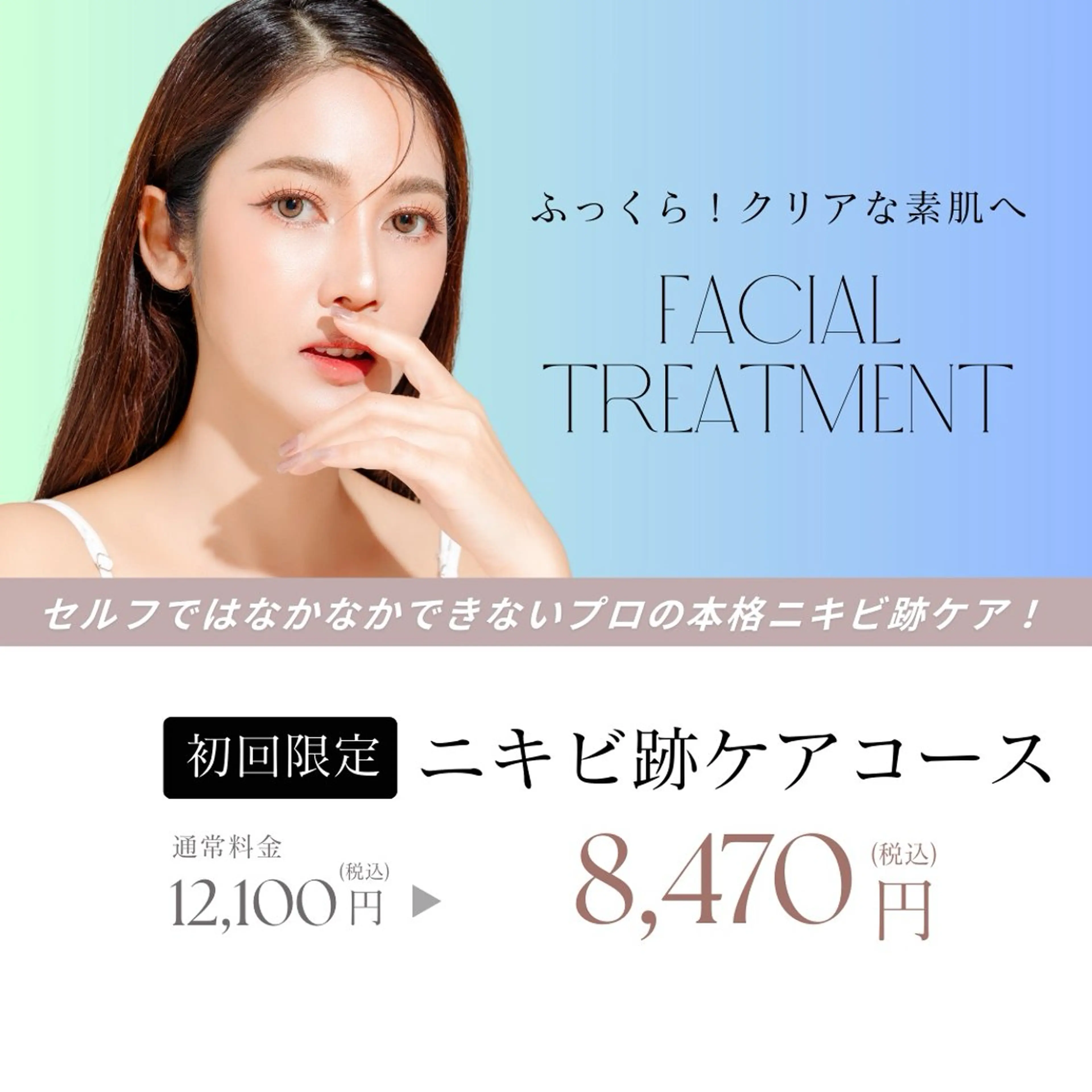 ◇IPL光フェイシャルフォトでニキビ跡・赤ら顔・シミケア◇くすみのない白いお肌への写真