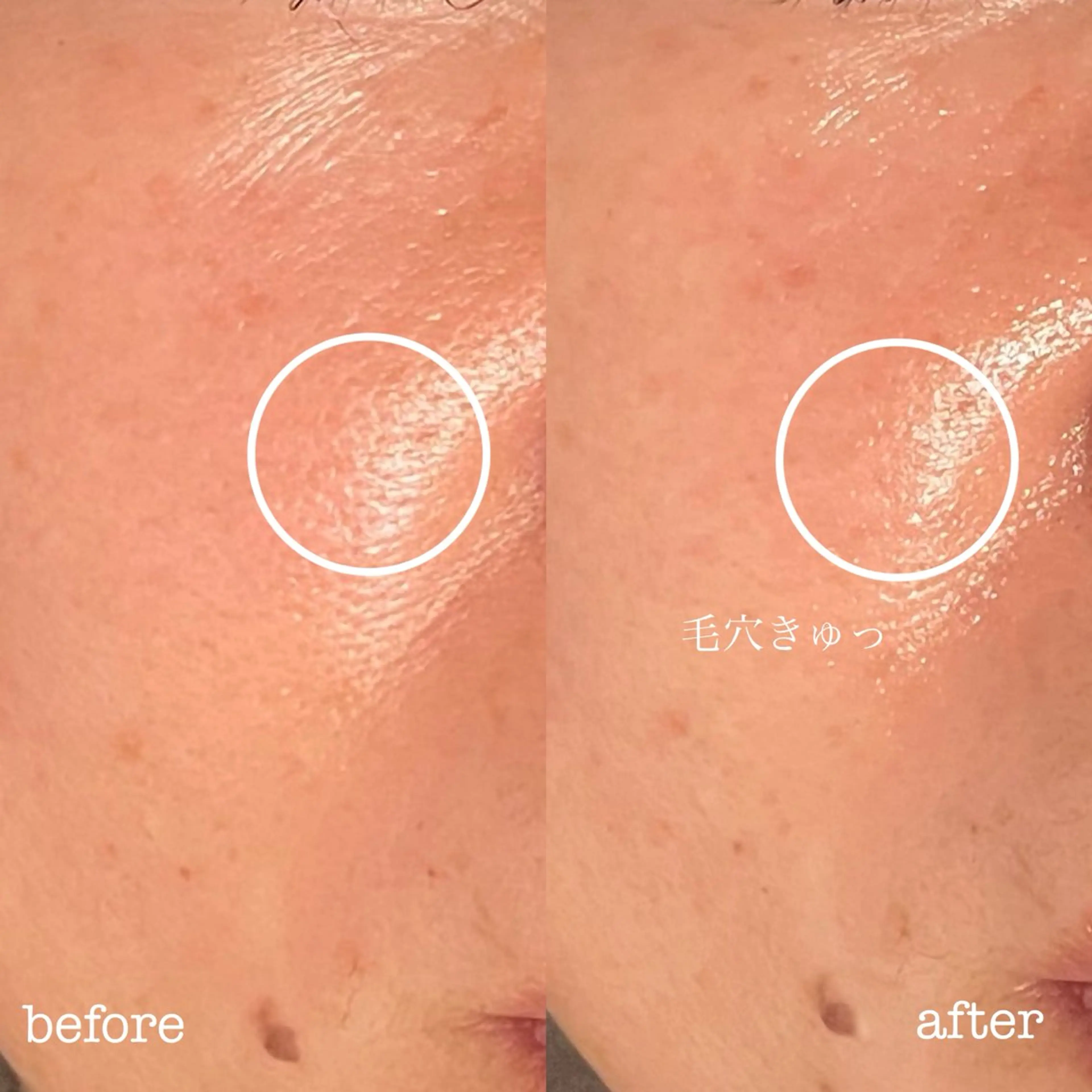 エステ フェイシャル専門店 regaloのエステ・リラクイメージ