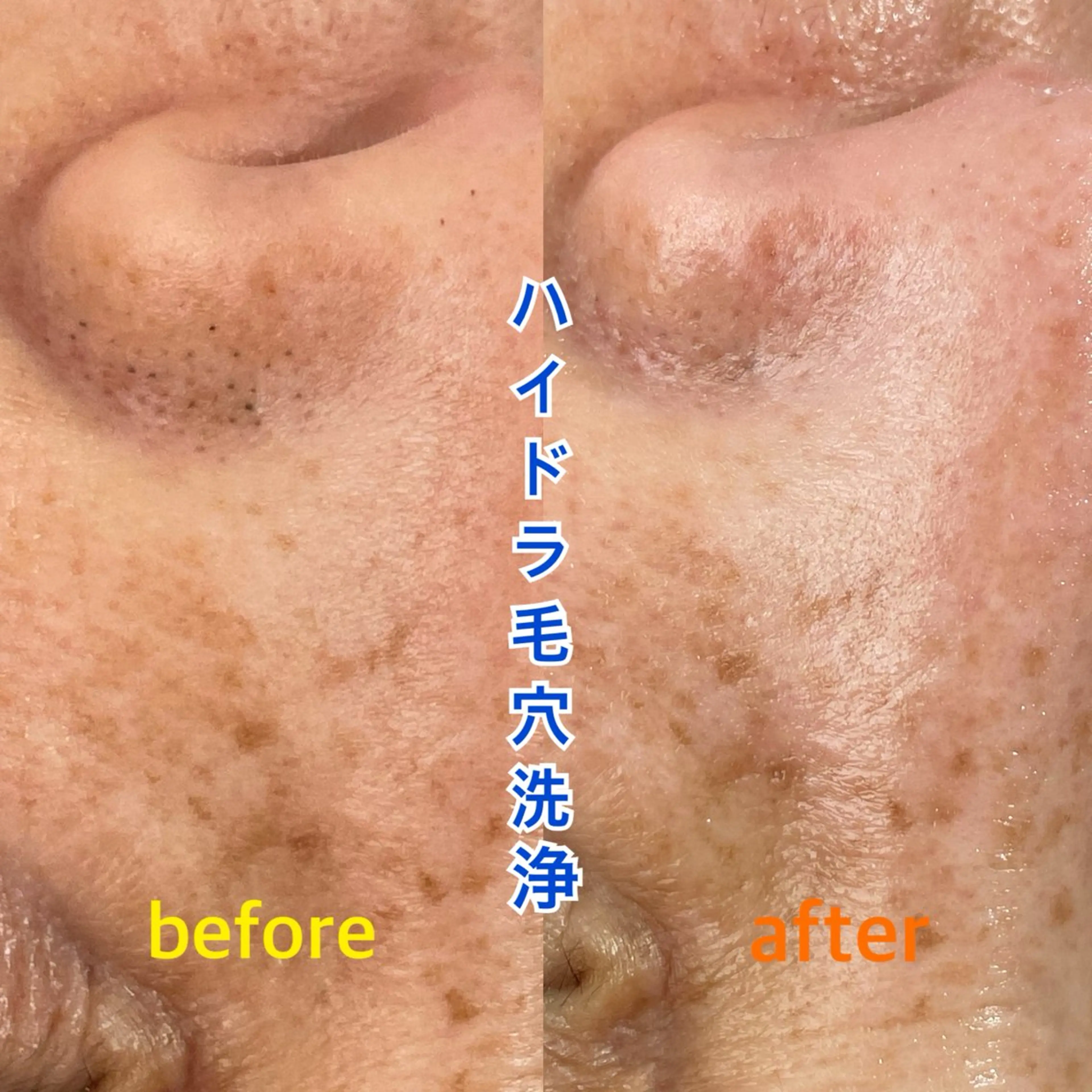 エステ Soin所属・Soin 身体＆お肌ケアのエステ・リラクイメージ