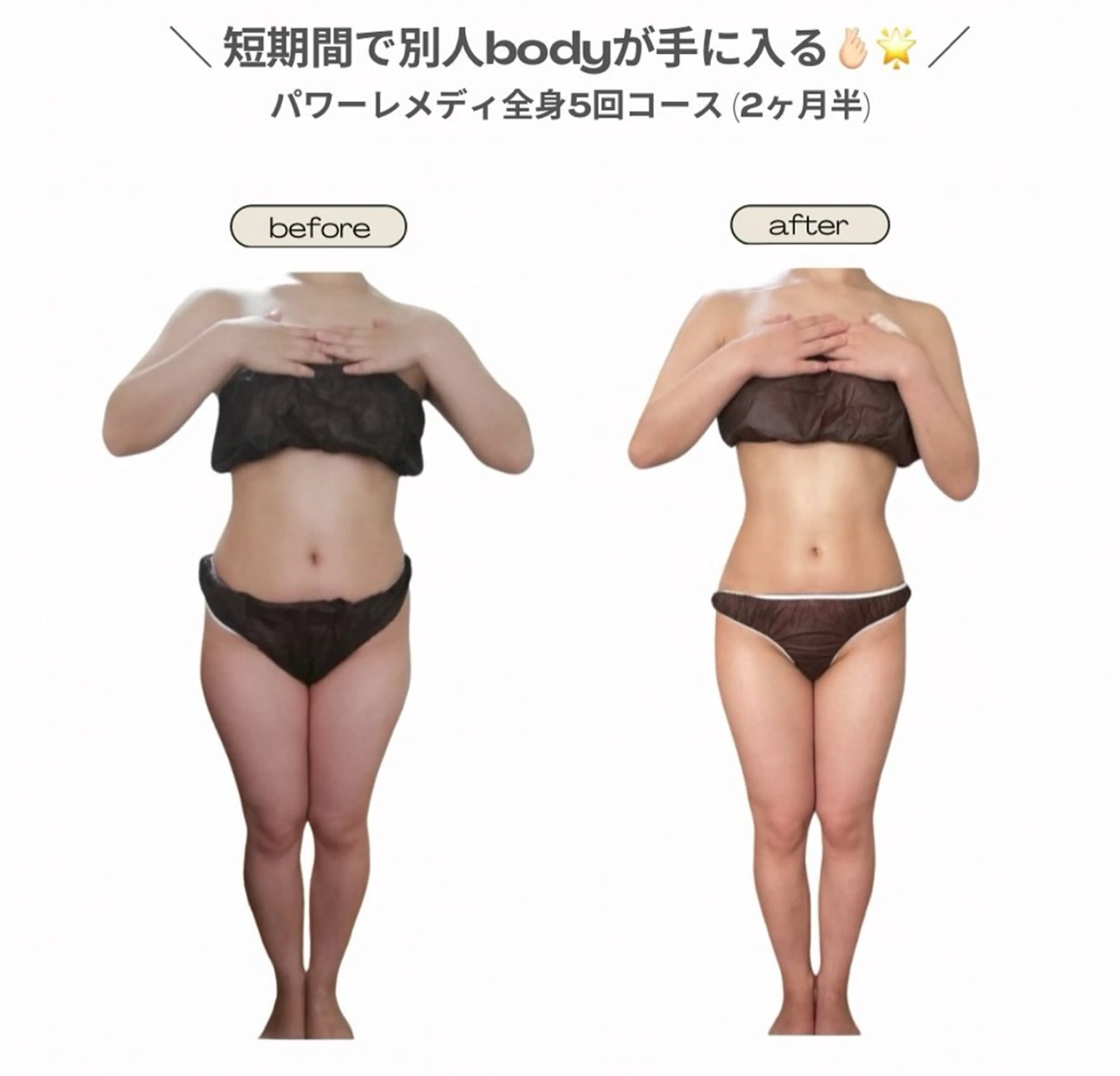 エステ リラク 《本気痩せ×疲労改善 》  BILOOPのエステ・リラクイメージ