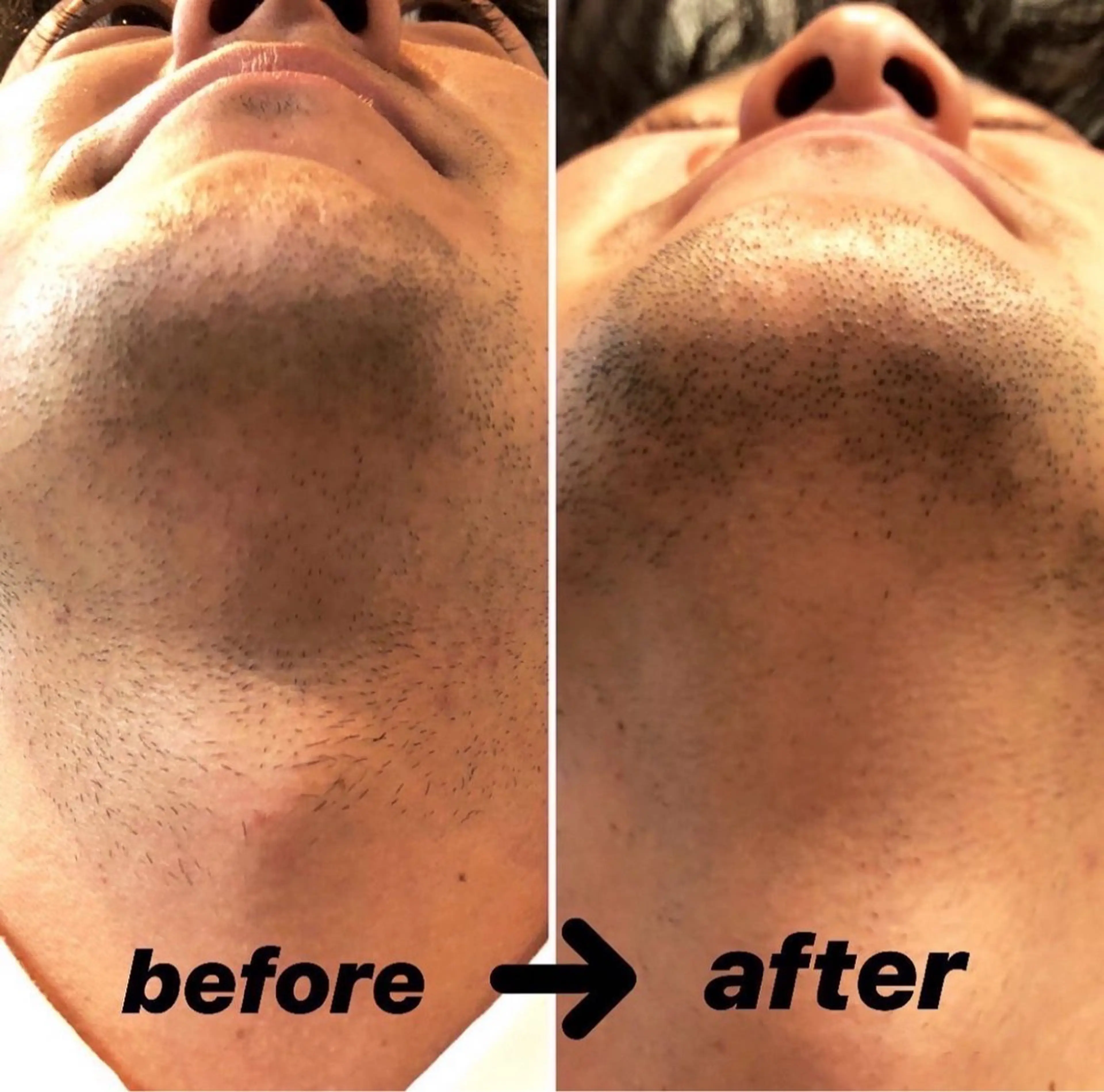 メンズ 脱毛 メンズアイブロウ BOSSのエステ・リラクイメージ