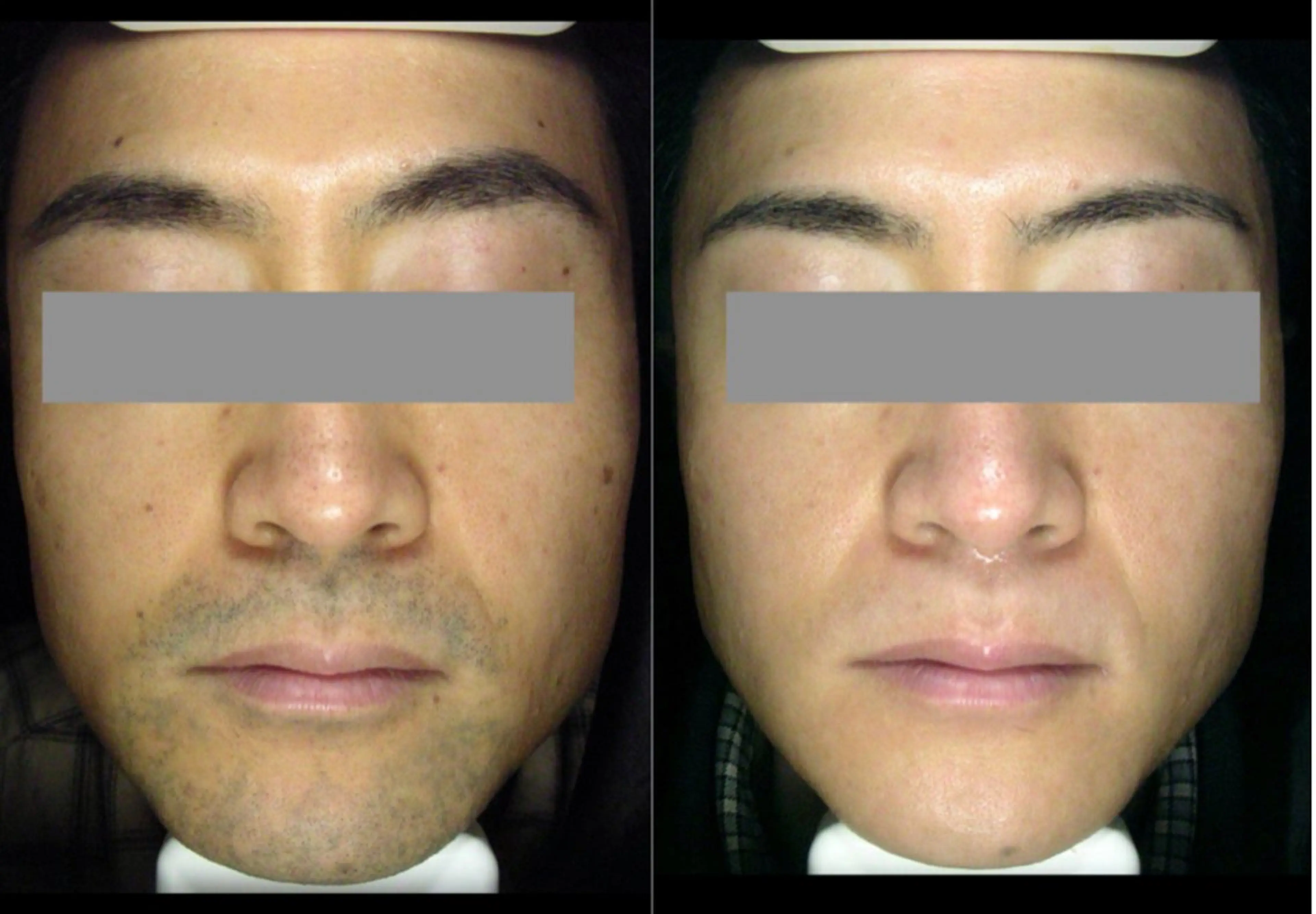 ホワイトニングジム 池袋のその他イメージ