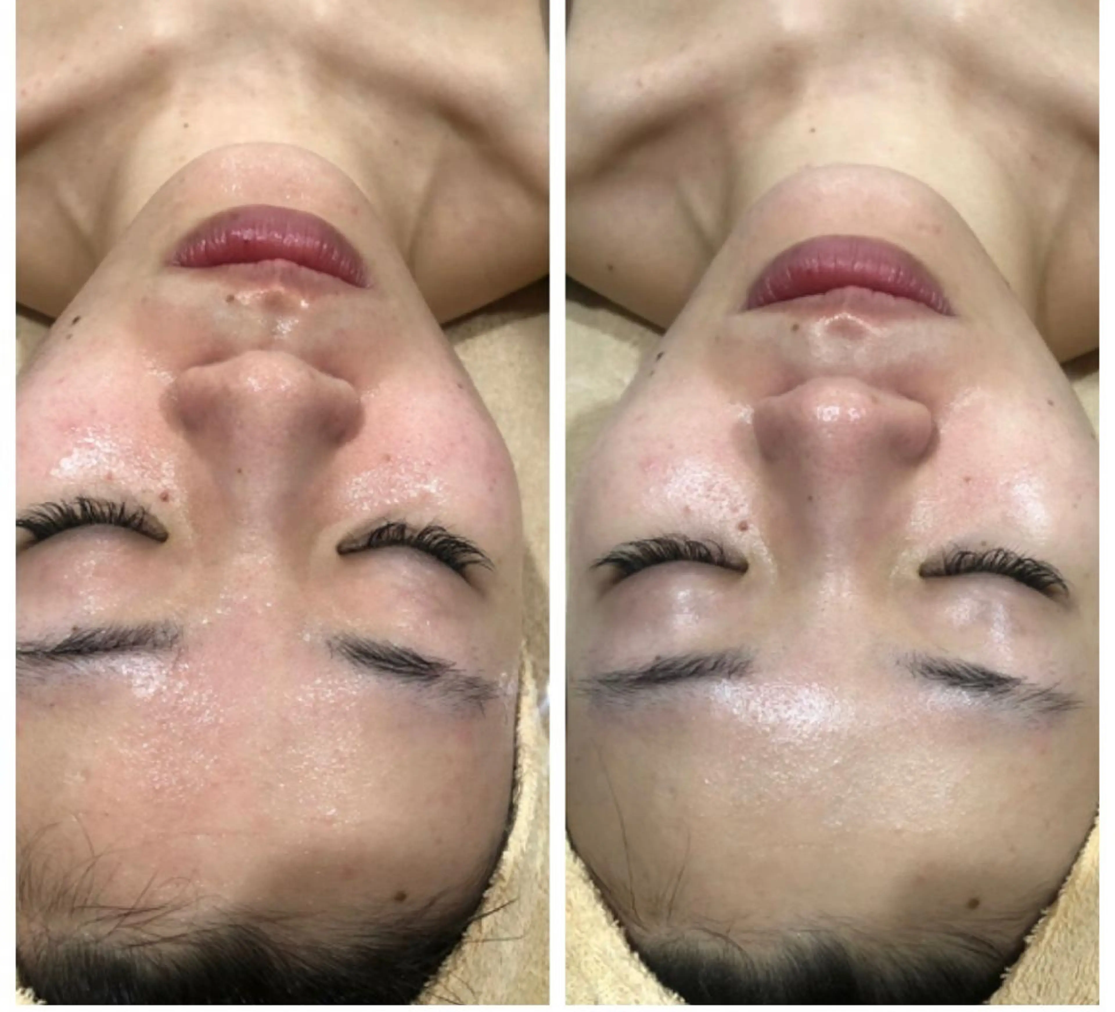 産後/ツヤ肌/子連れ /保育士在籍サロンのエステ・リラクイメージ