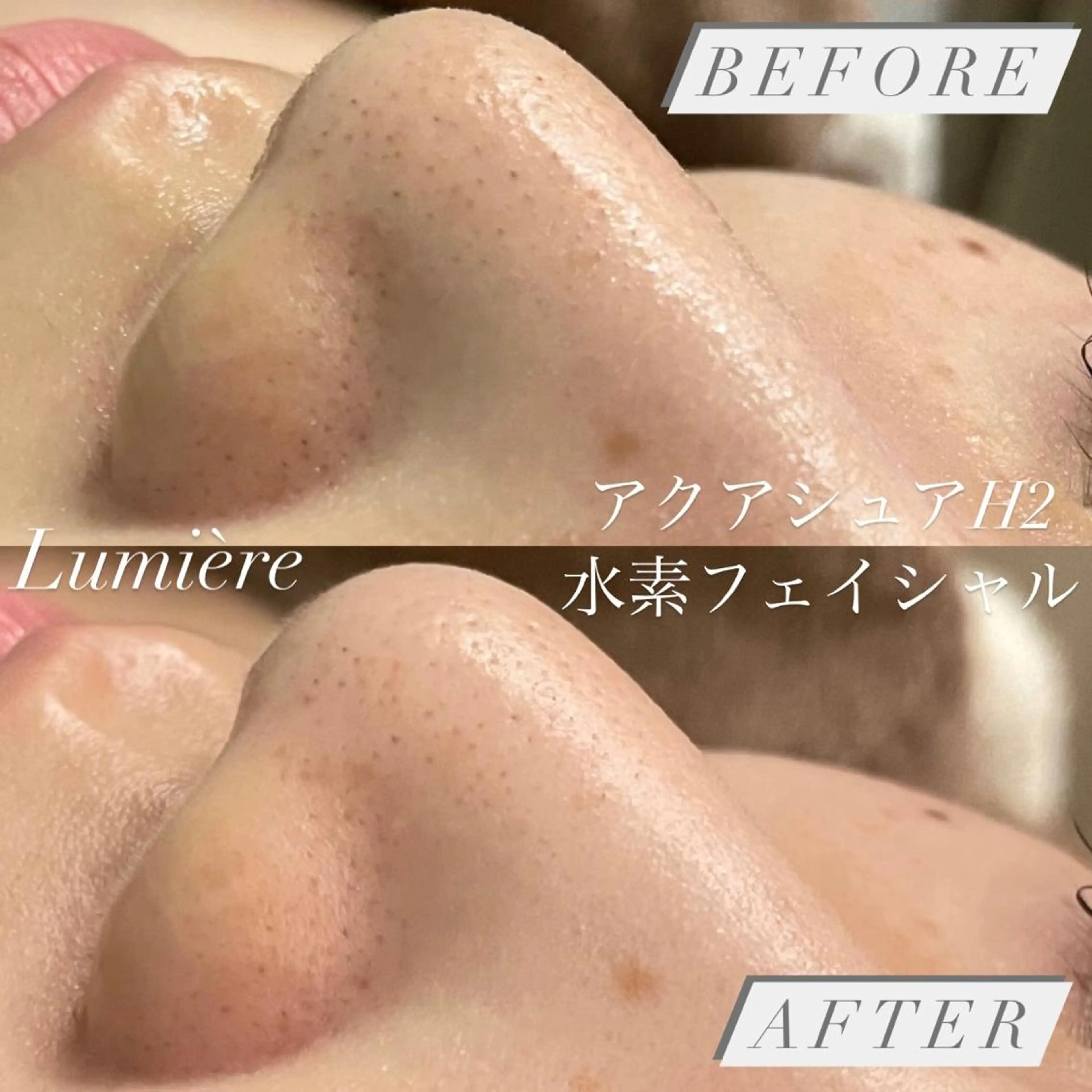 エステ 小顔・美肌 ルミエールのエステ・リラクイメージ