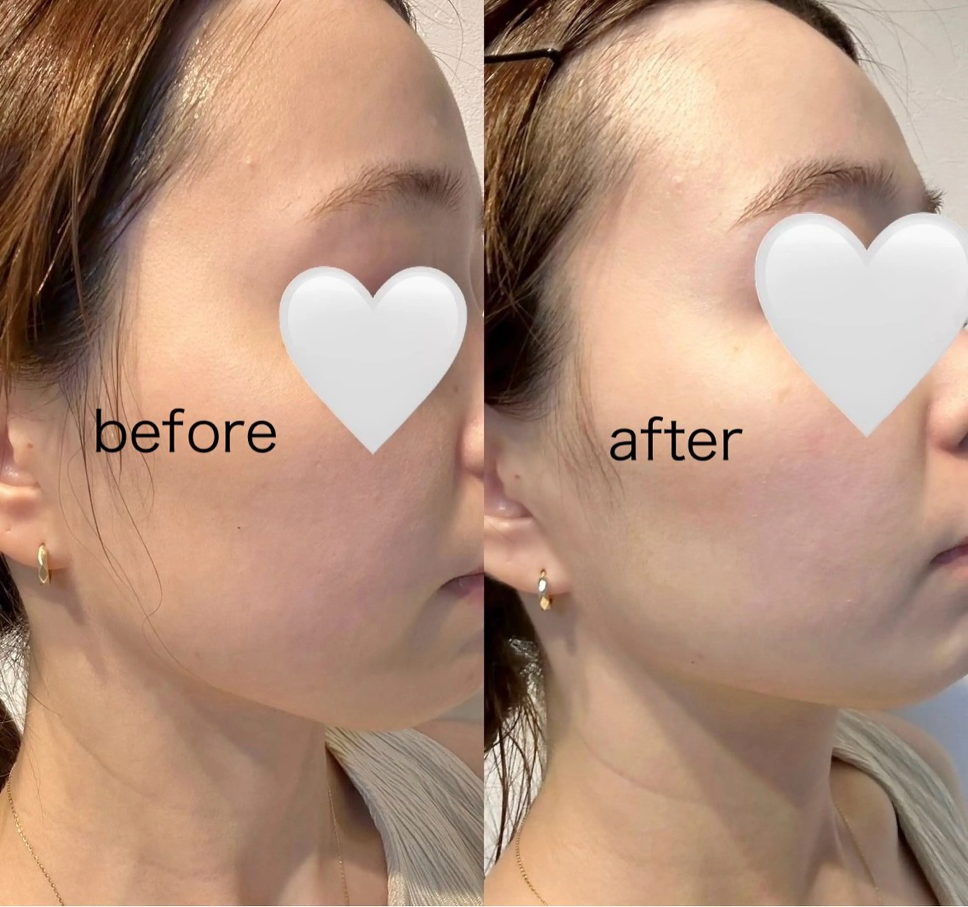 エステ 美容サロン réposのその他イメージ