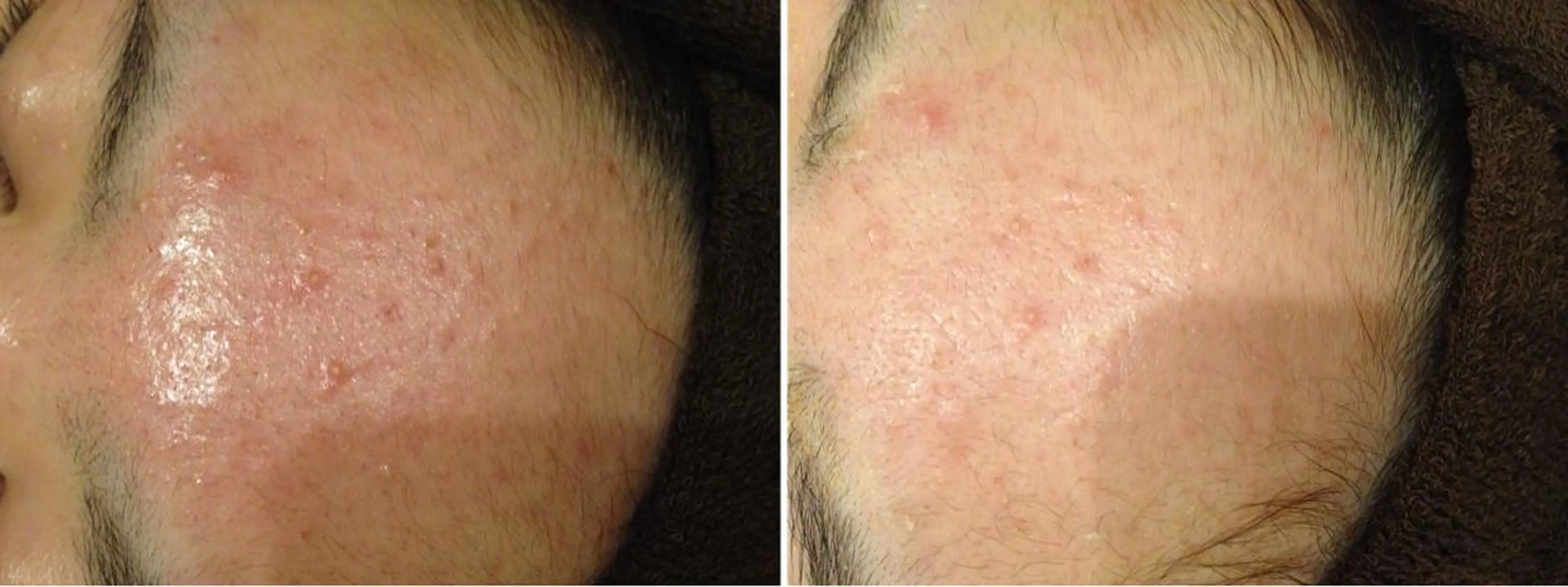 アニメ,Vオタク× 即効痩せエステサロンのエステ・リラクイメージ