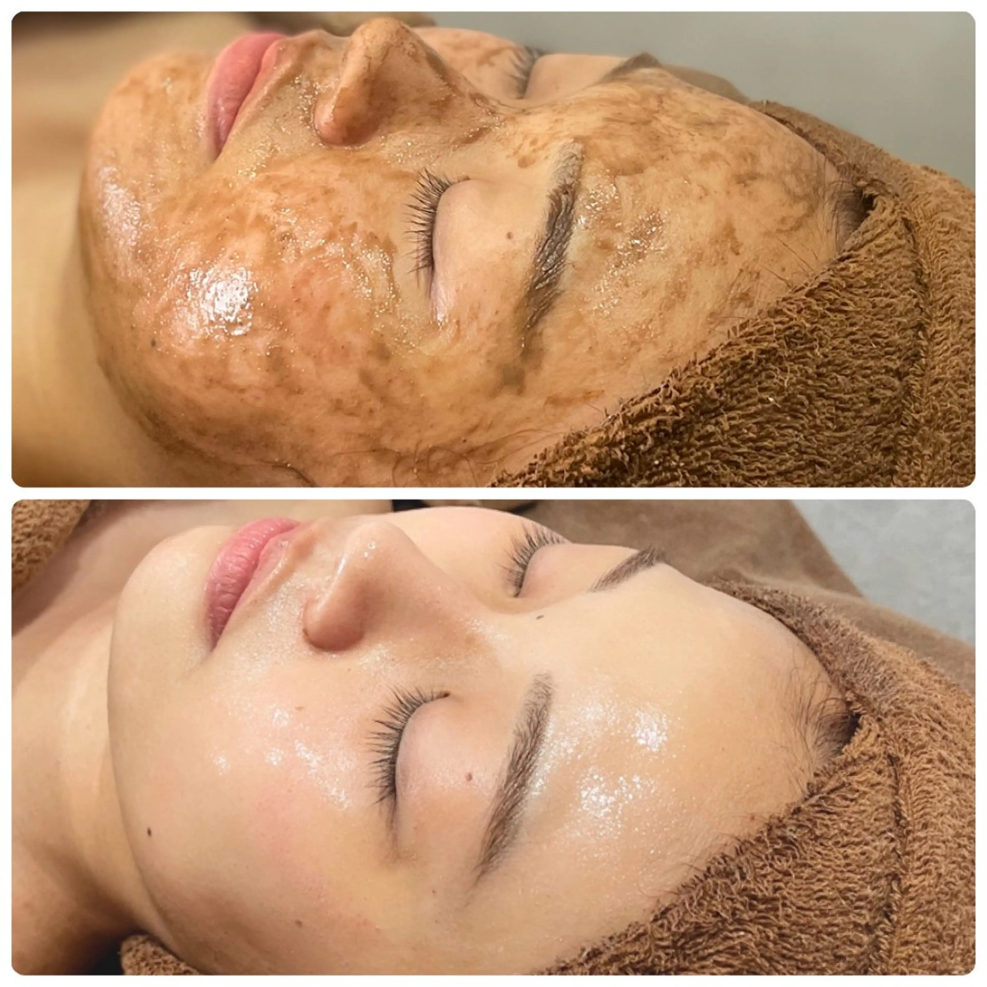 TLIENGLE高宮 エステ・ネイルのエステ・リラクイメージ