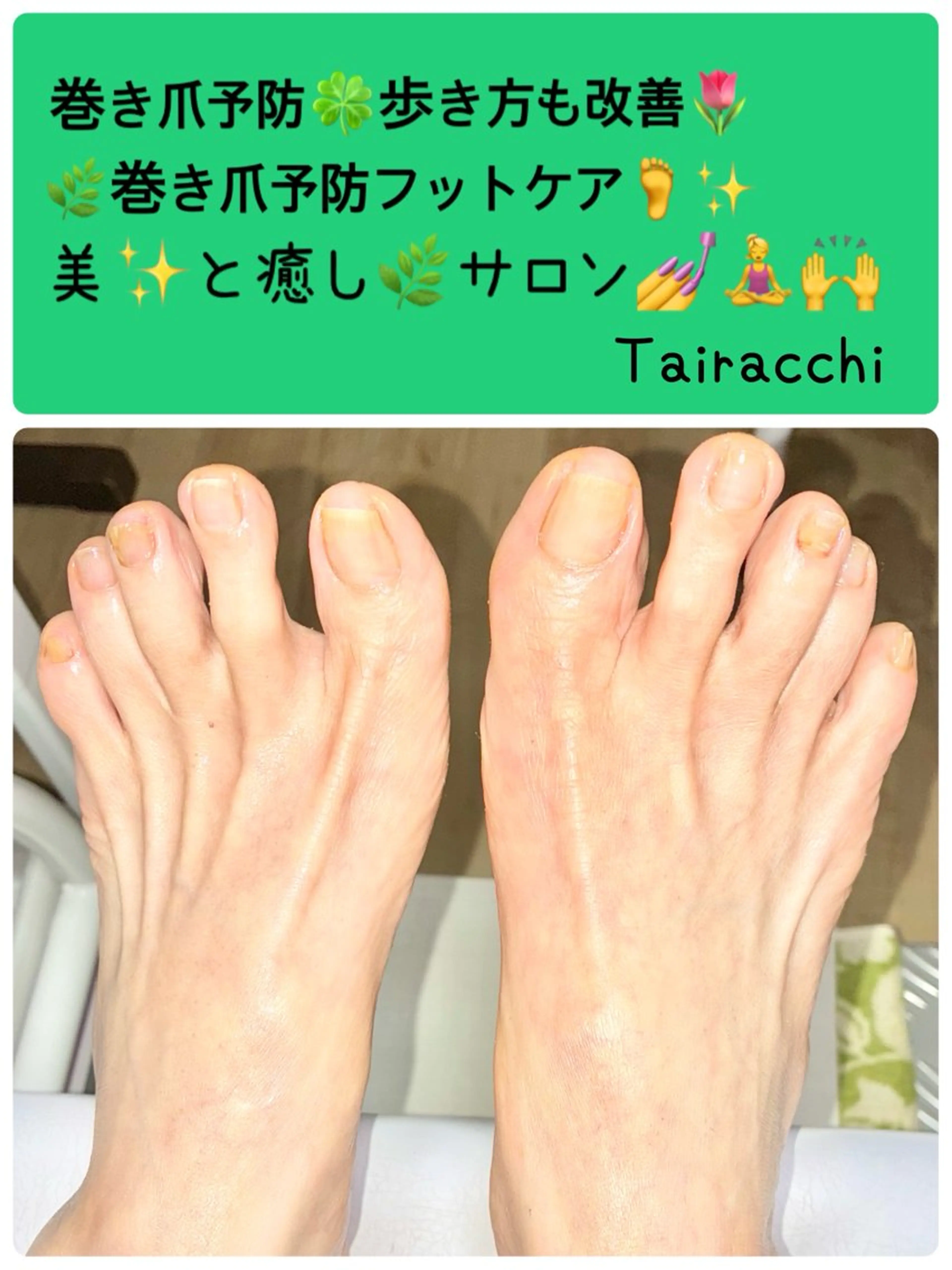 ネイル フットネイル フットネイル Tairacchi タイラッチのネイルデザイン