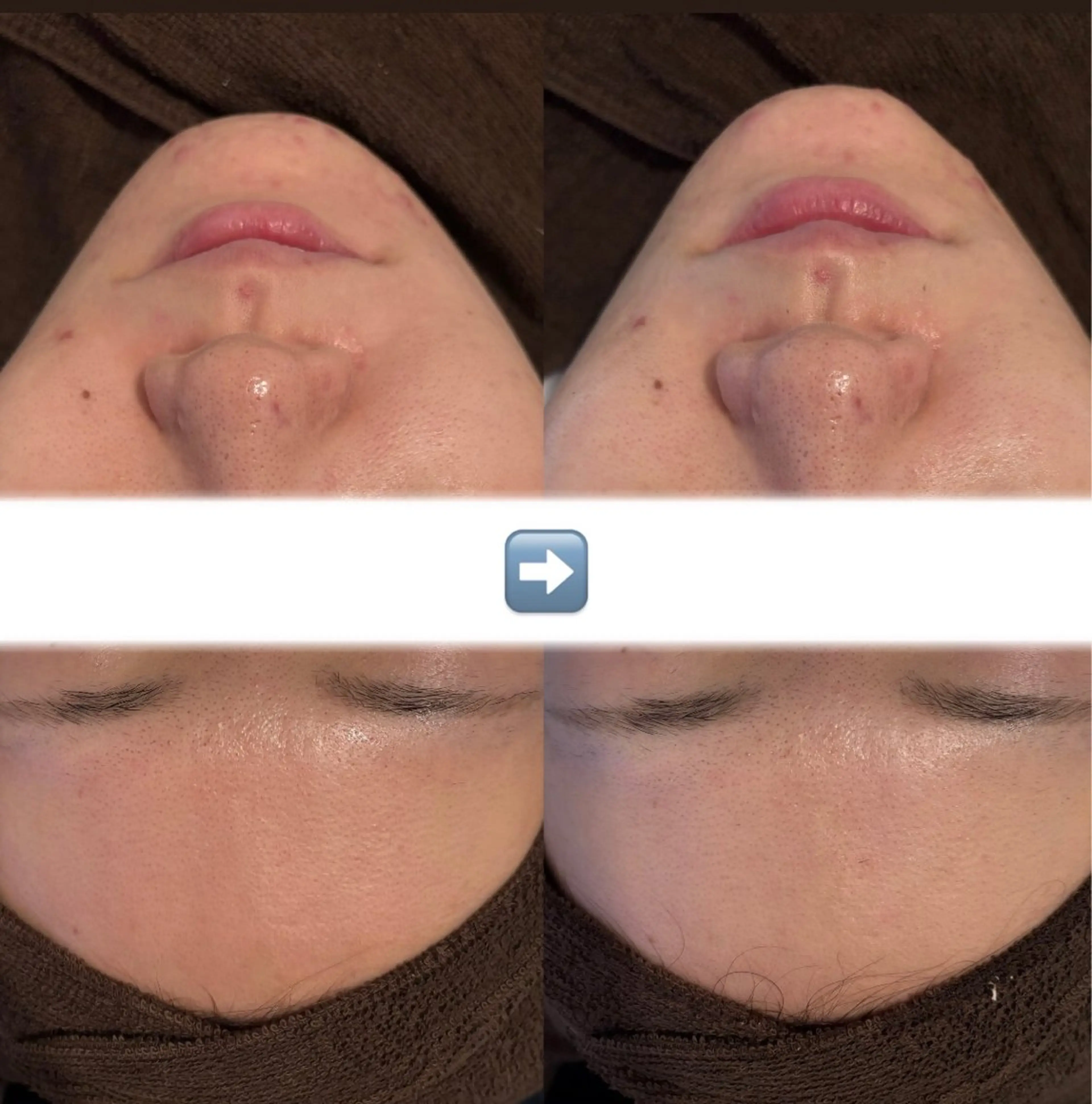 韓国肌管理Belle 赤羽のエステ・リラクイメージ