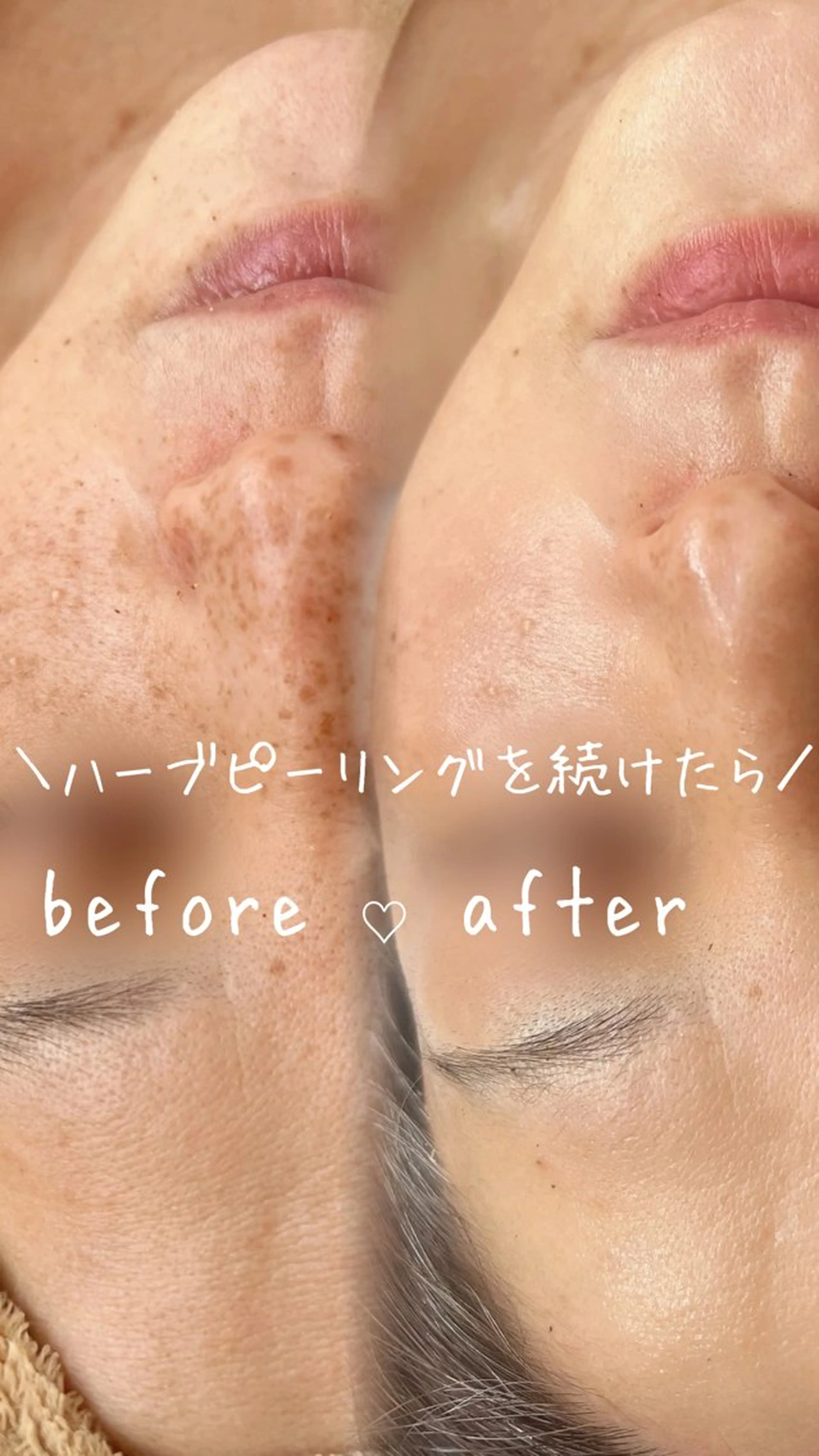 エステ miki 東根の肌質改善サロンのエステ・リラクイメージ