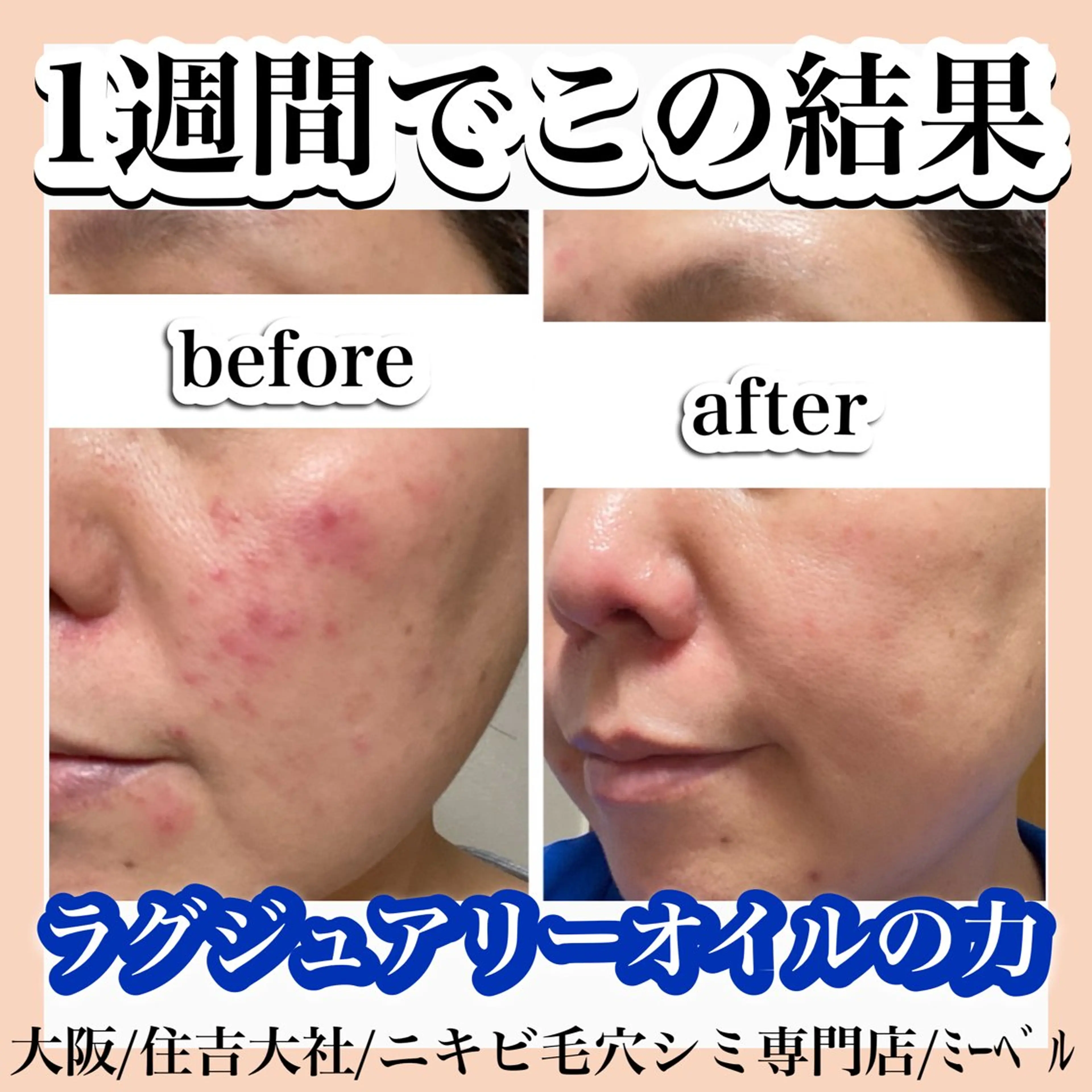 salon  mebell所属・肌管理専門店 mebell天王寺店のエステ・リラクイメージ