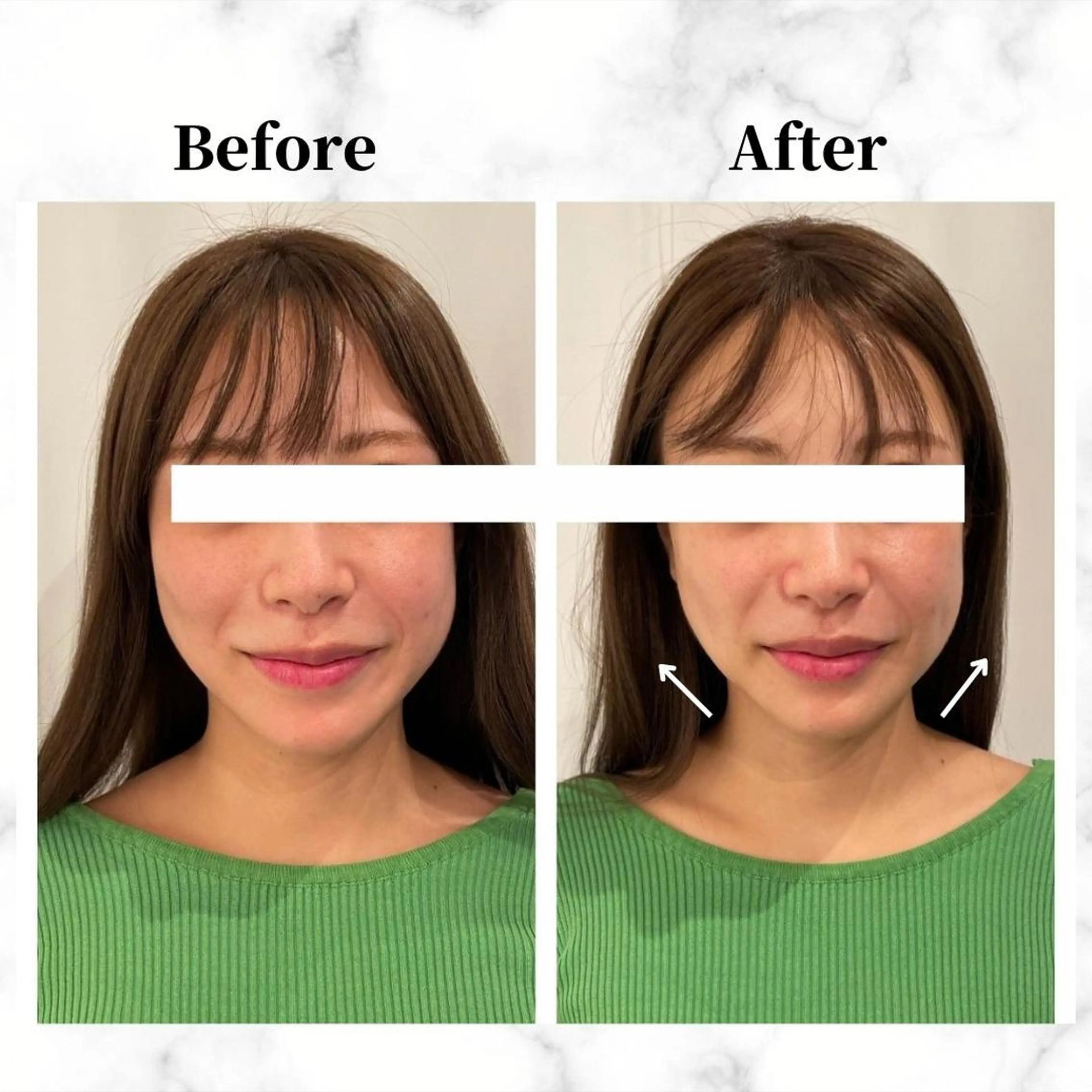 エステ リラク 12Dハイフ💗 最強小顔のエステ・リラクイメージ