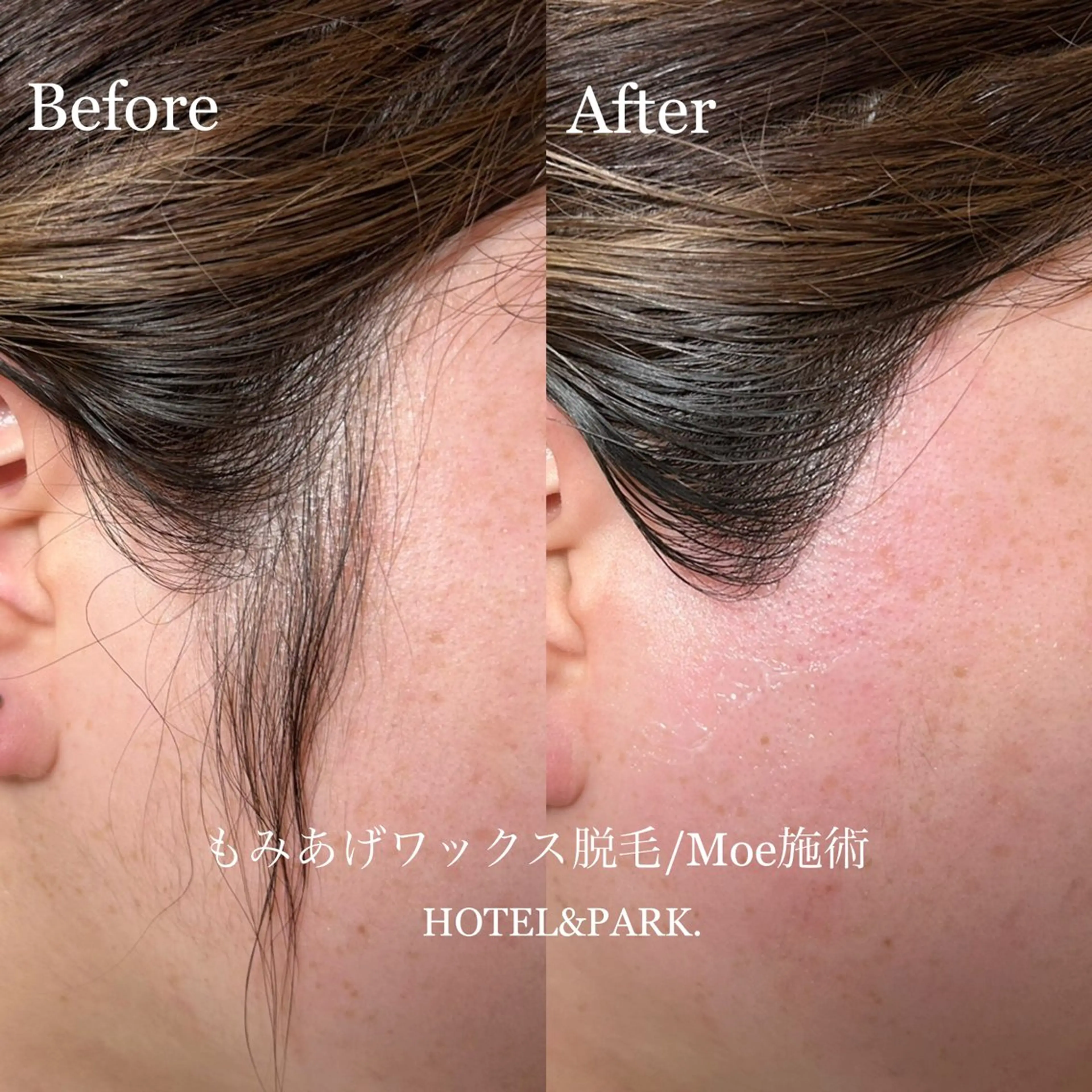 HOTEL&PARK .Moeワックス脱毛のエステ・リラクイメージ