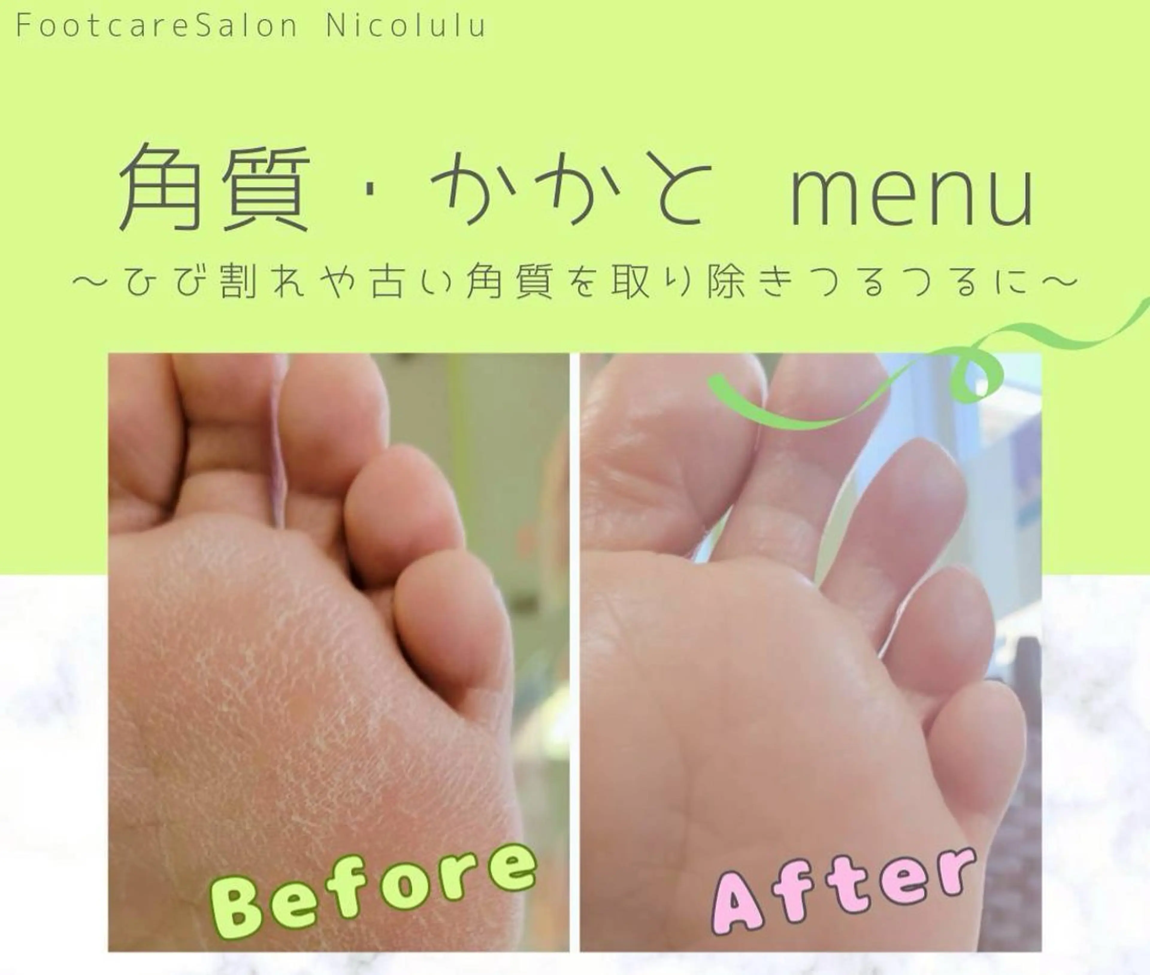 メンズ リラク 足トラブル専門 ニコルル金沢のエステ・リラクイメージ