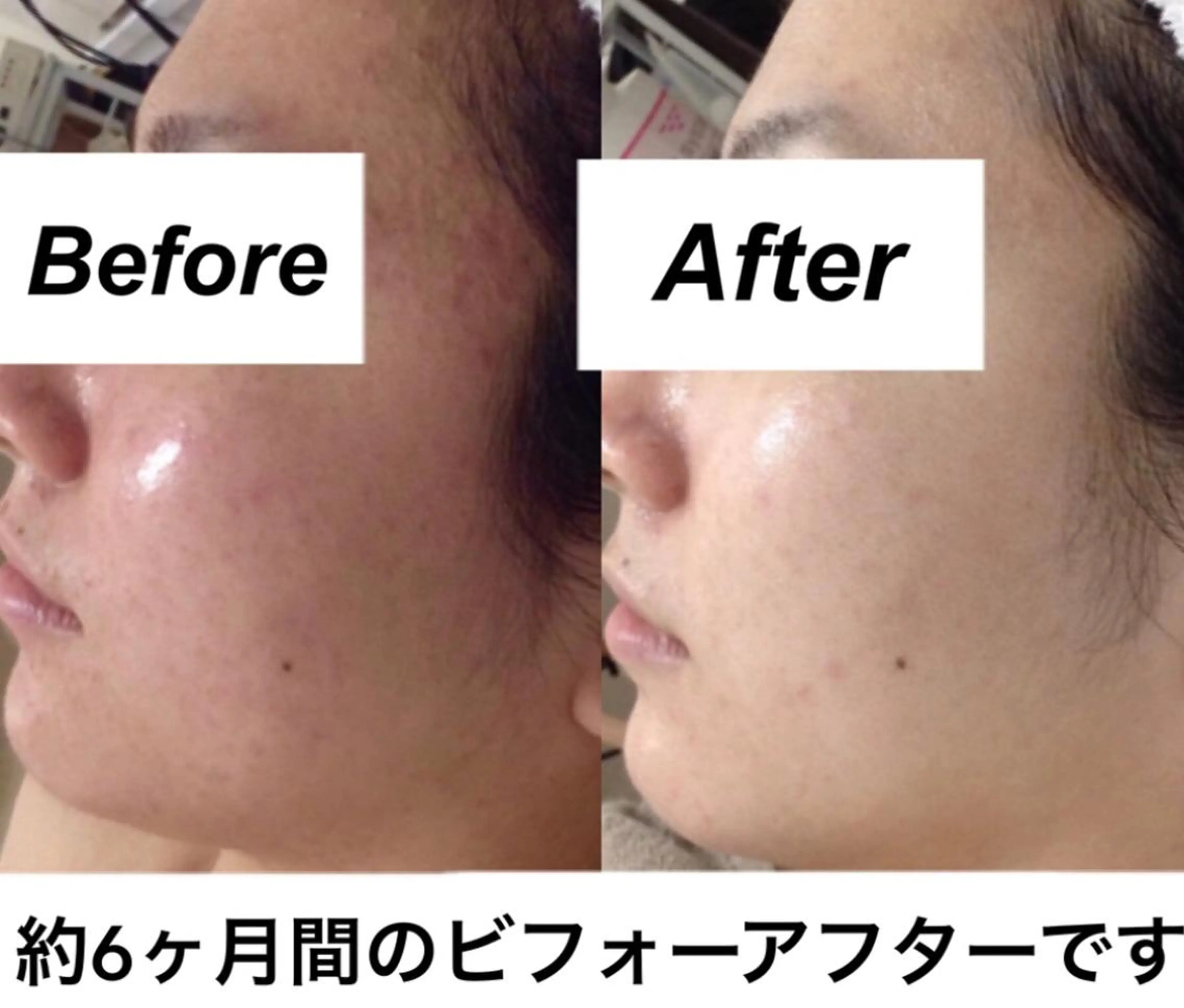 エステ リラク 都度払い肌質改善 &脱毛Blancheのエステ・リラクイメージ