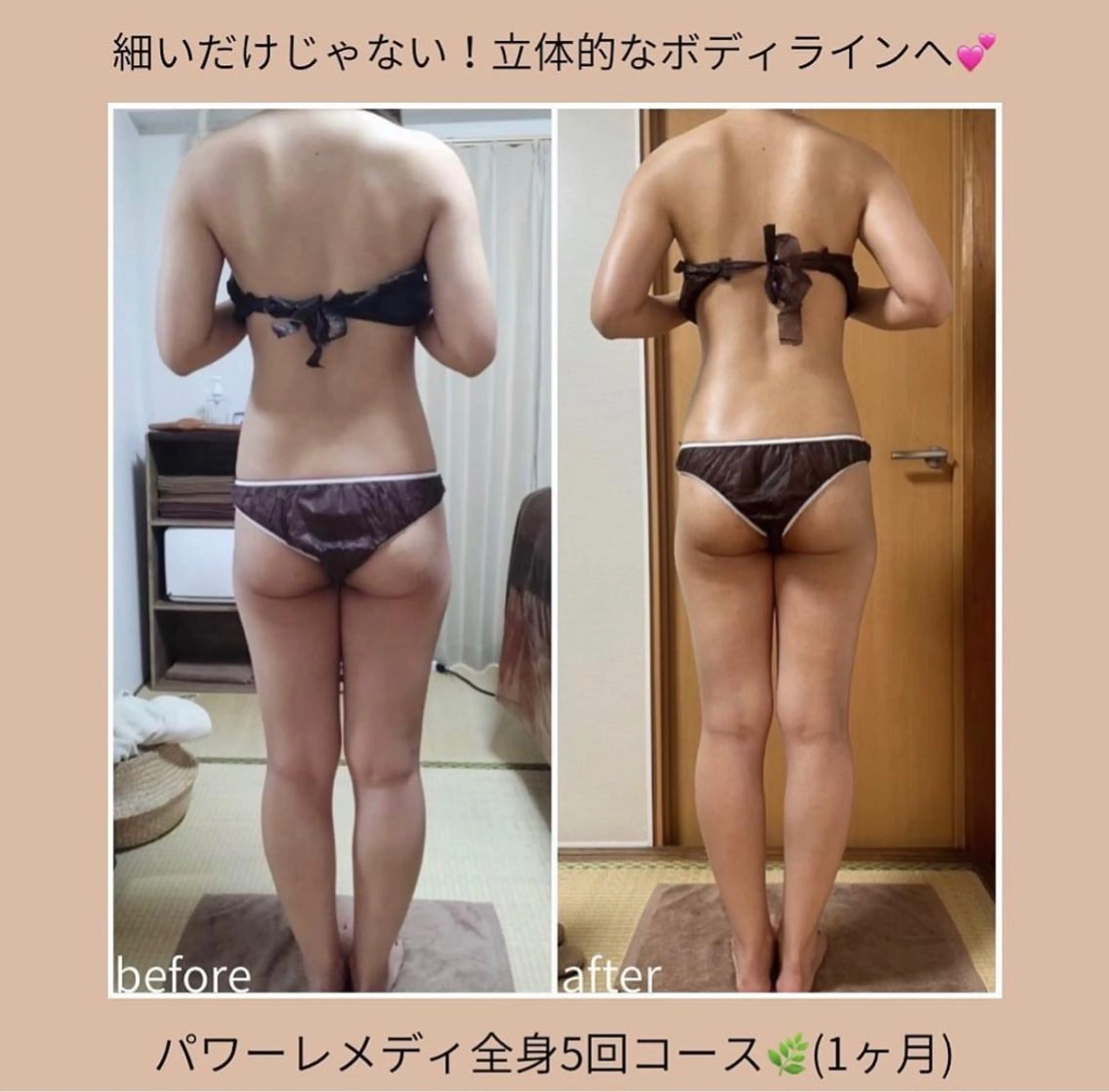 biloop所属・《本気痩せ×疲労改善 》 BILOOPのエステ・リラクイメージ