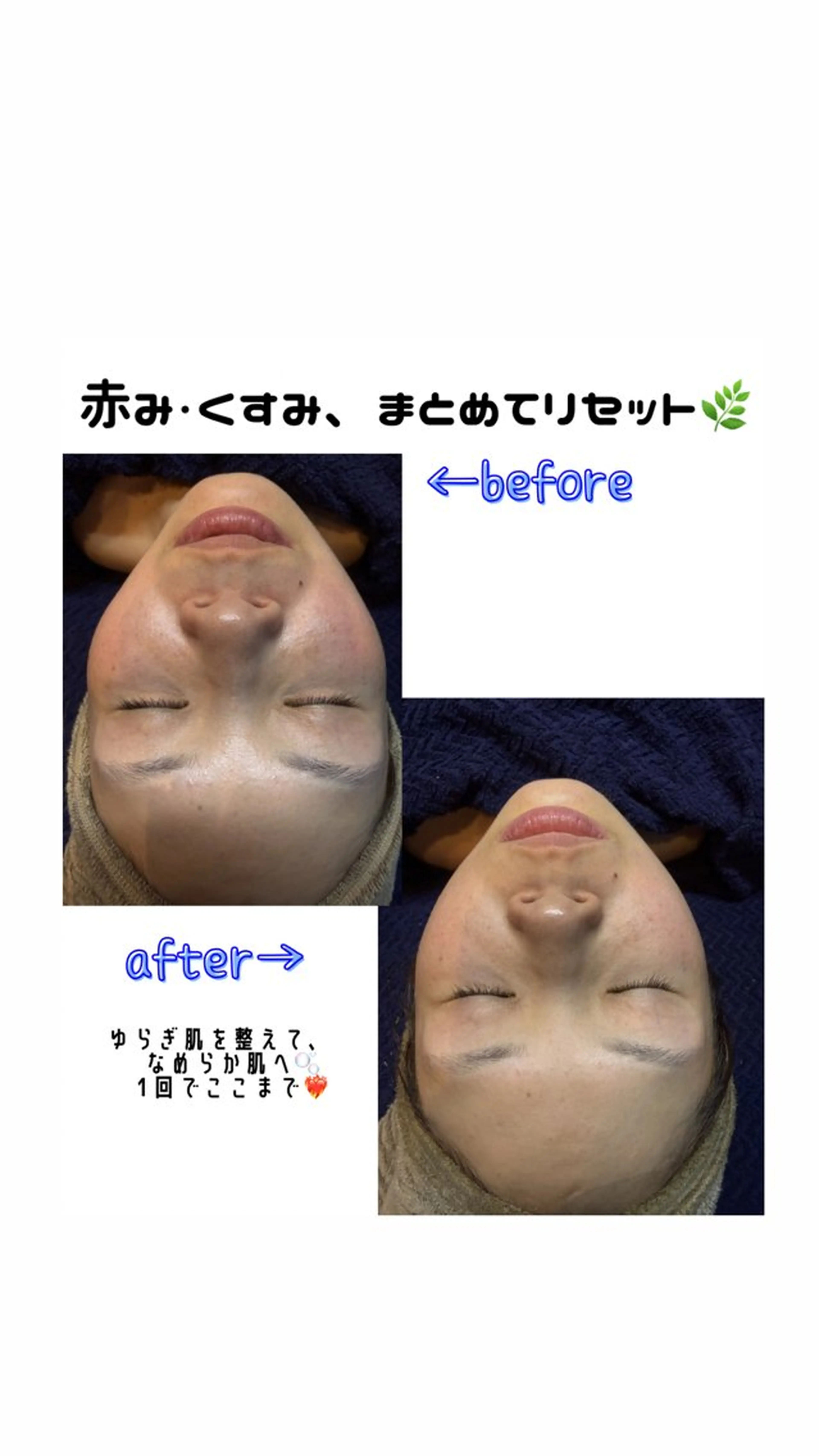 エステ リラク ハーブピーリング専門 店Oneのエステ・リラクイメージ