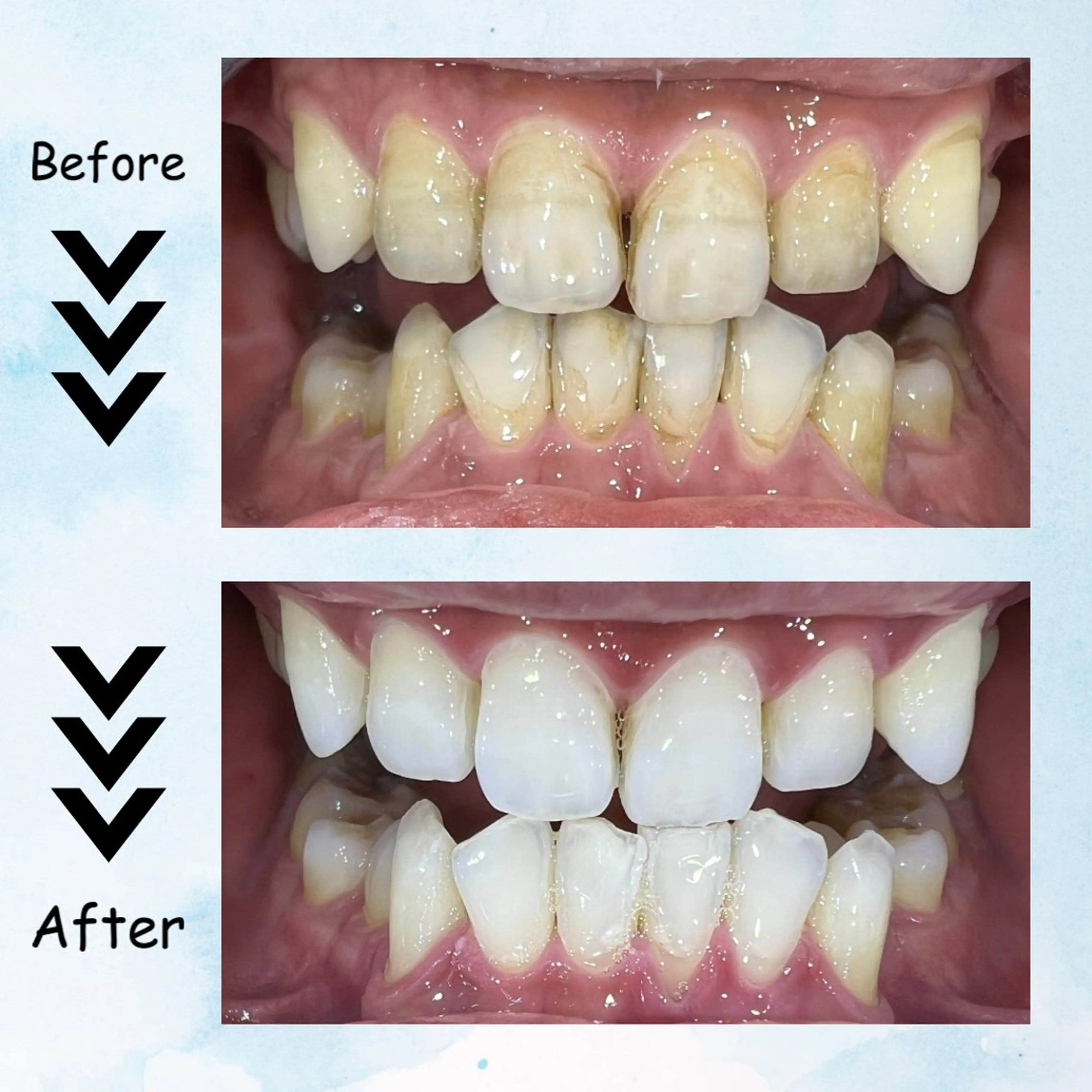 メンズ その他 セルフホワイトニング エクシア塩釜口駅前店のその他イメージ