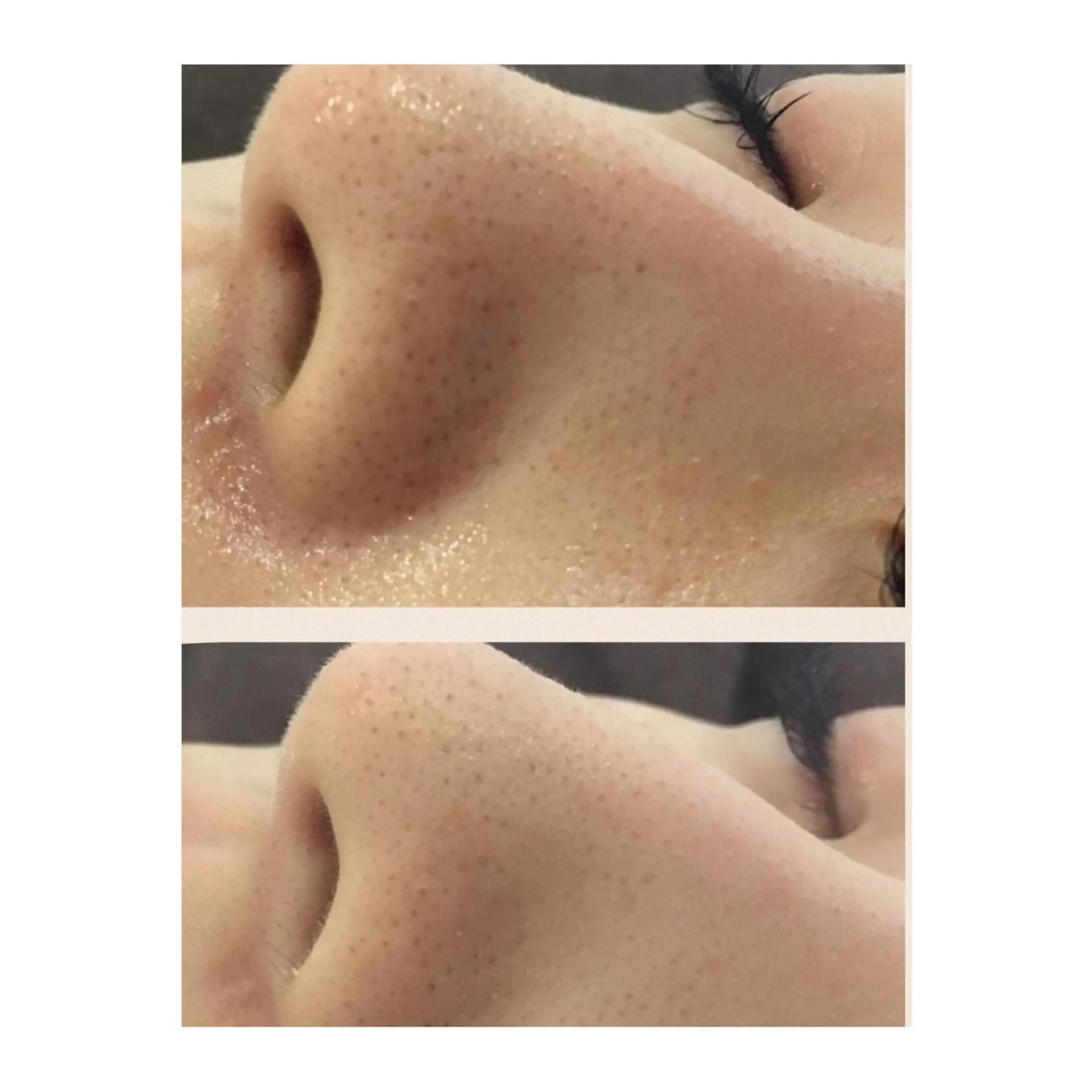 メンズ 金の糸脱毛 産毛ケア専門のエステ・リラクイメージ