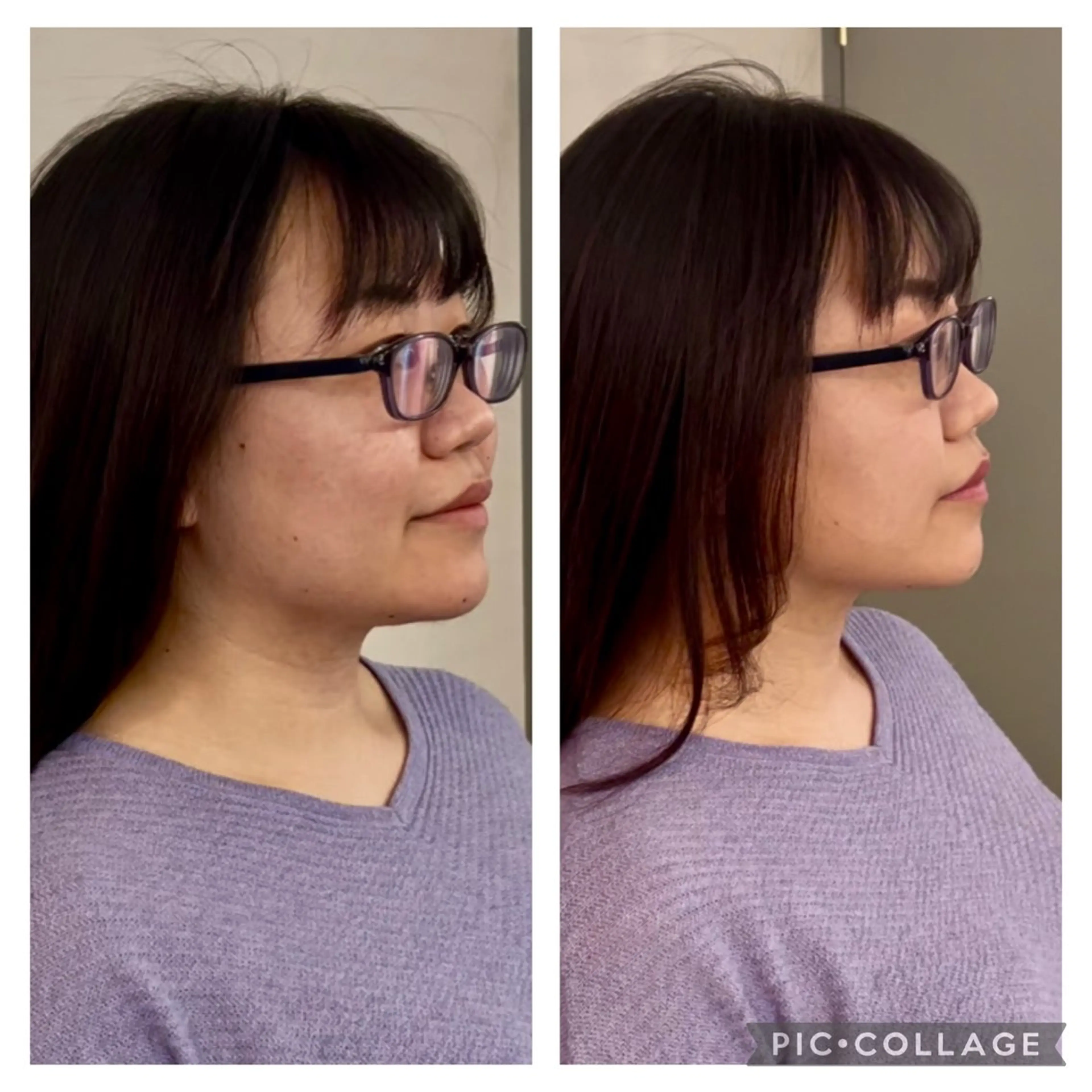 衝撃小顔コース！顔を一回り小さくリフトアップ！目はパッチリ！小顔に特化したスキンケアとゴッドハンドで頭痛、目の疲れにも◎の写真