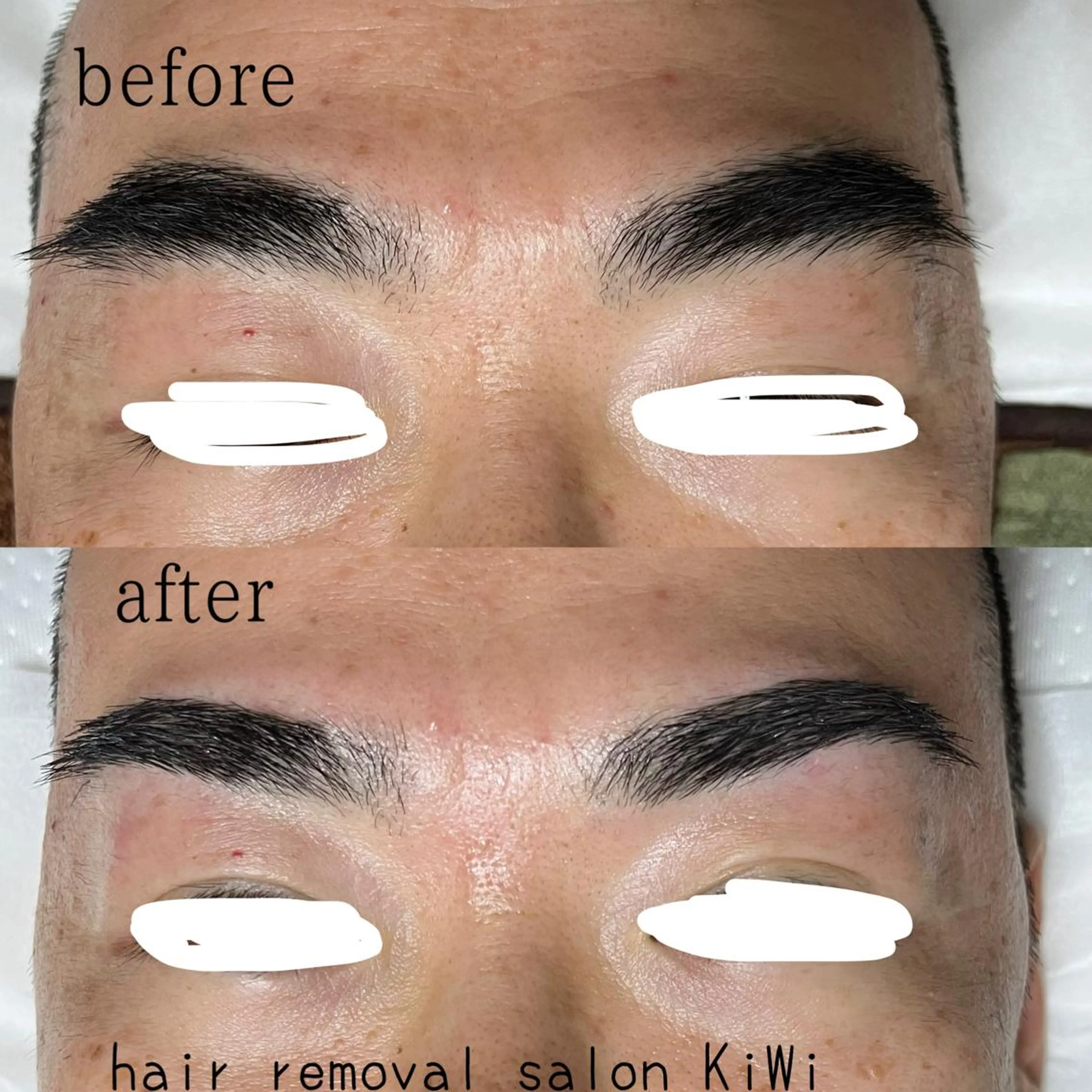 アイブロウ メンズアイブロウ 眉毛ワックス脱毛 脱毛サロン KiWiのエステ・リラクイメージ