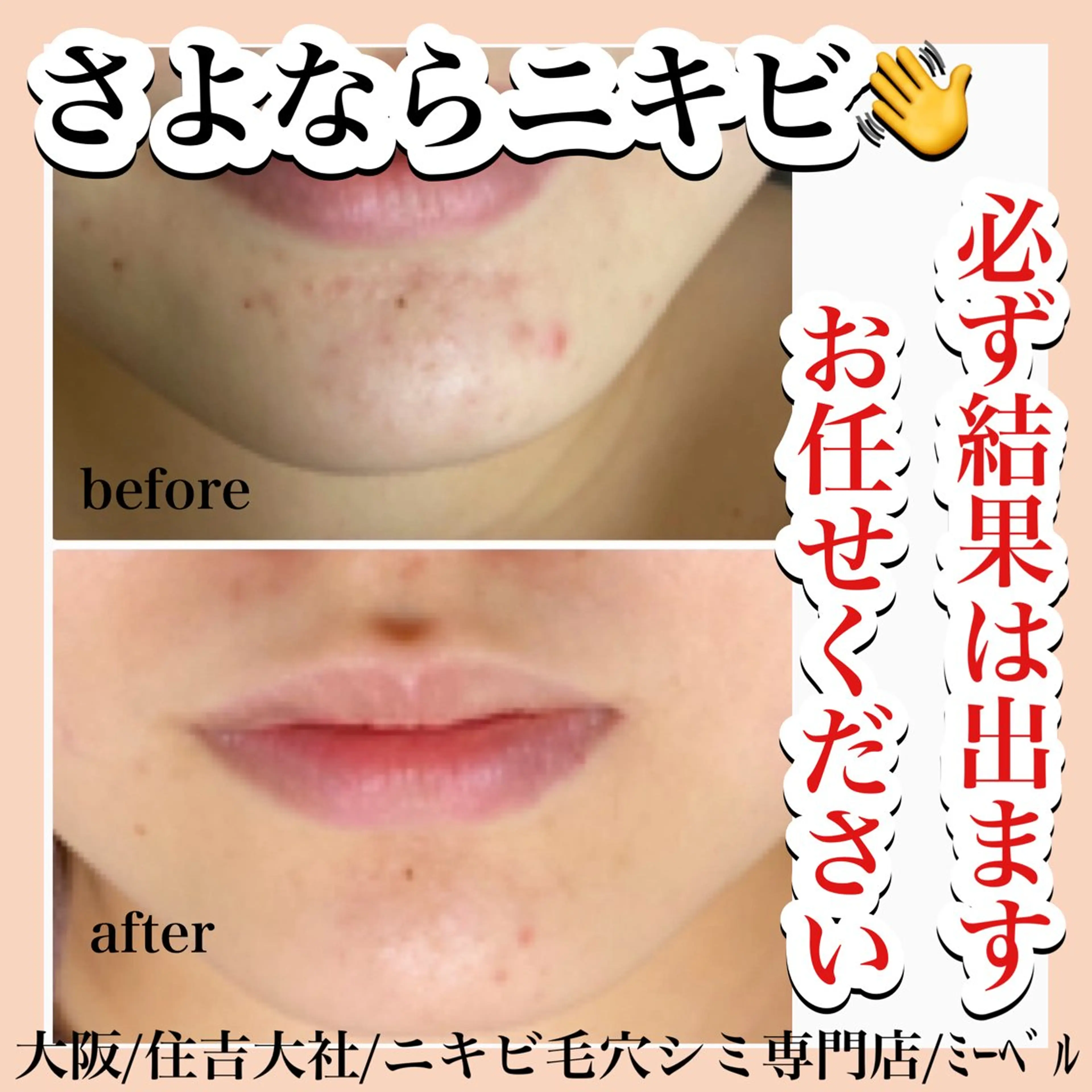 エステ リラク salon  mebell所属・肌管理専門店 mebell天王寺店のエステ・リラクイメージ