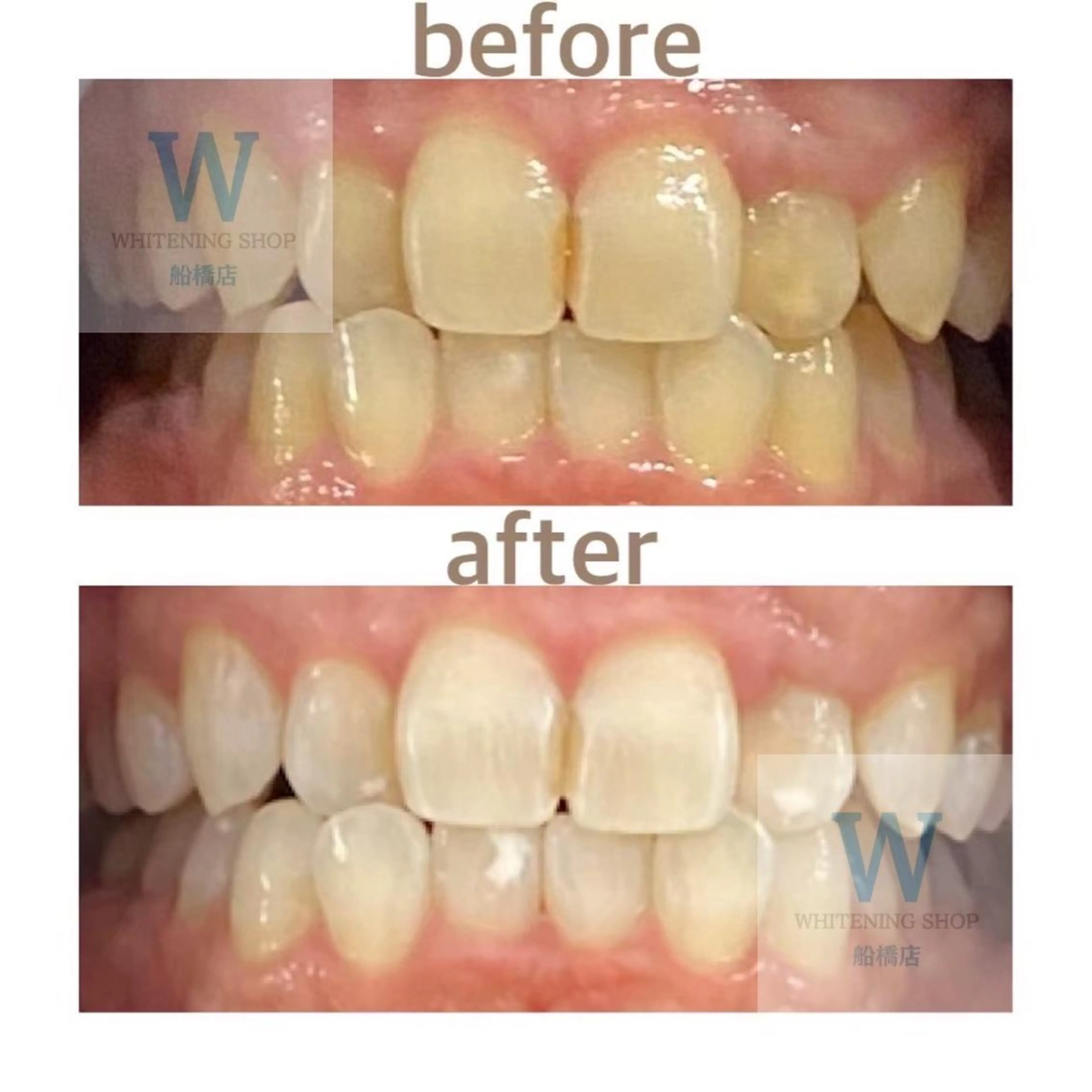 エステ リラク ホワイトニング ショップ船橋２号店のエステ・リラクイメージ