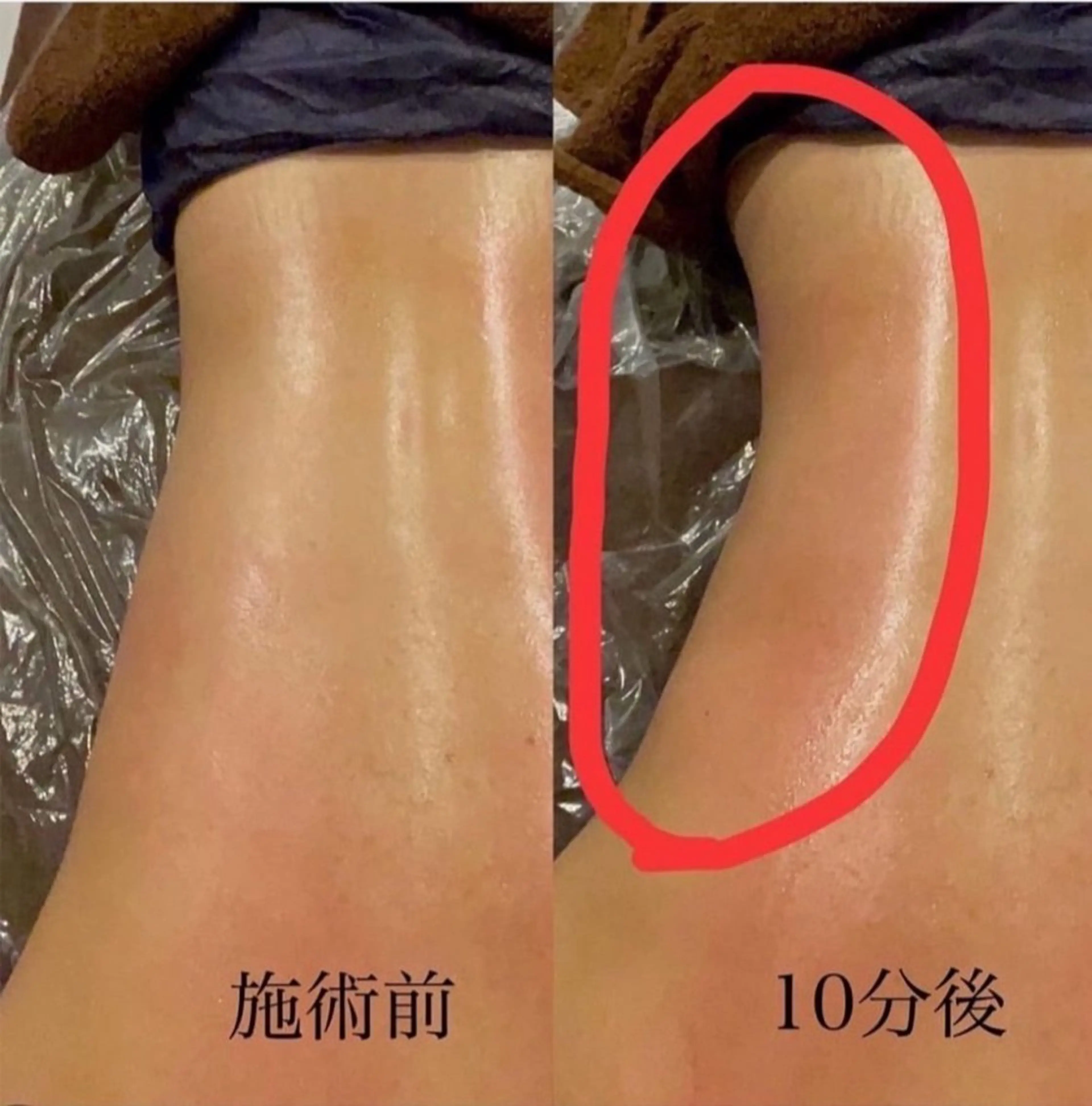 エステ Micell beautyのエステ・リラクイメージ