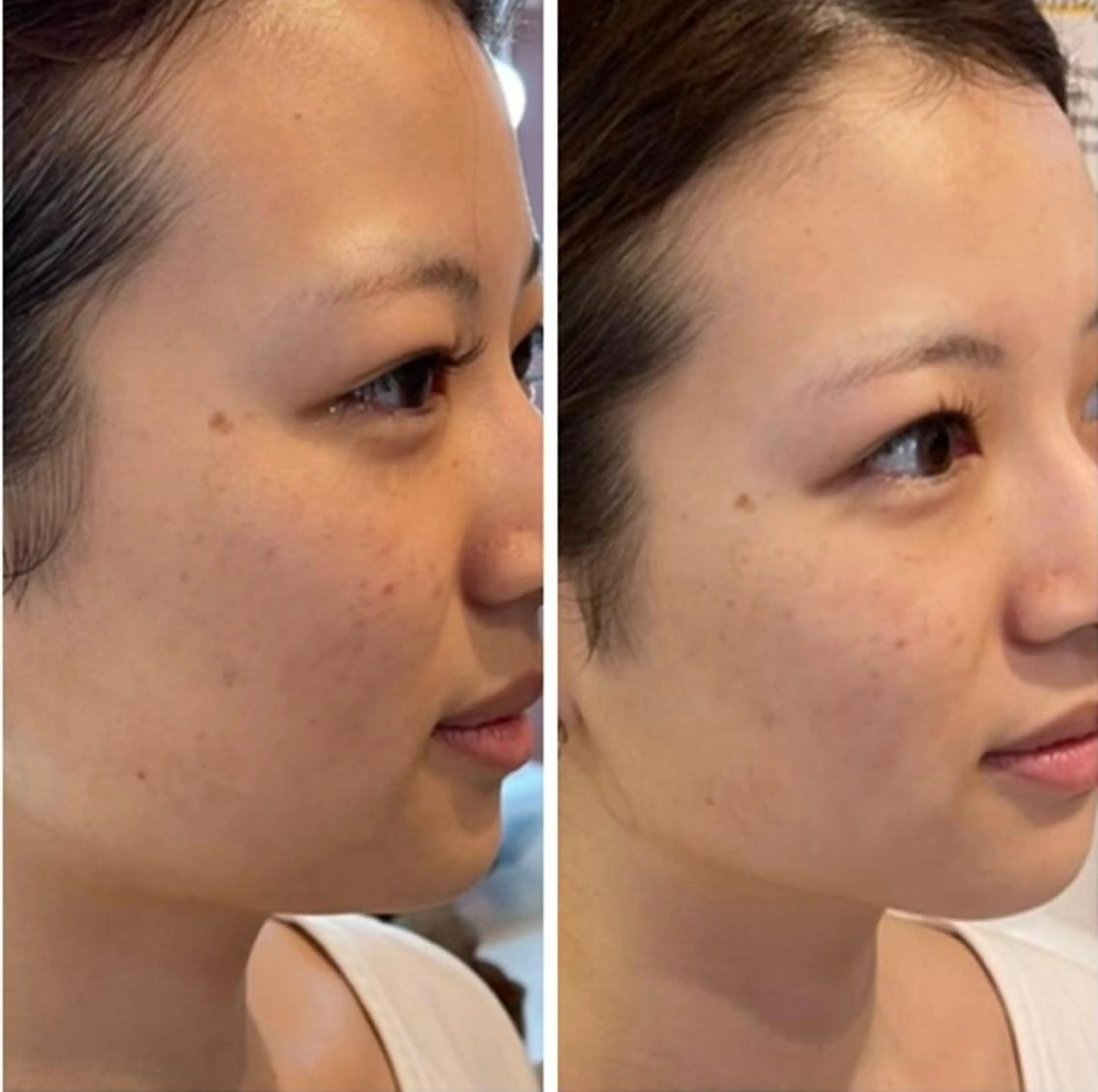 別府脱毛サロン Grandeのエステ・リラクイメージ