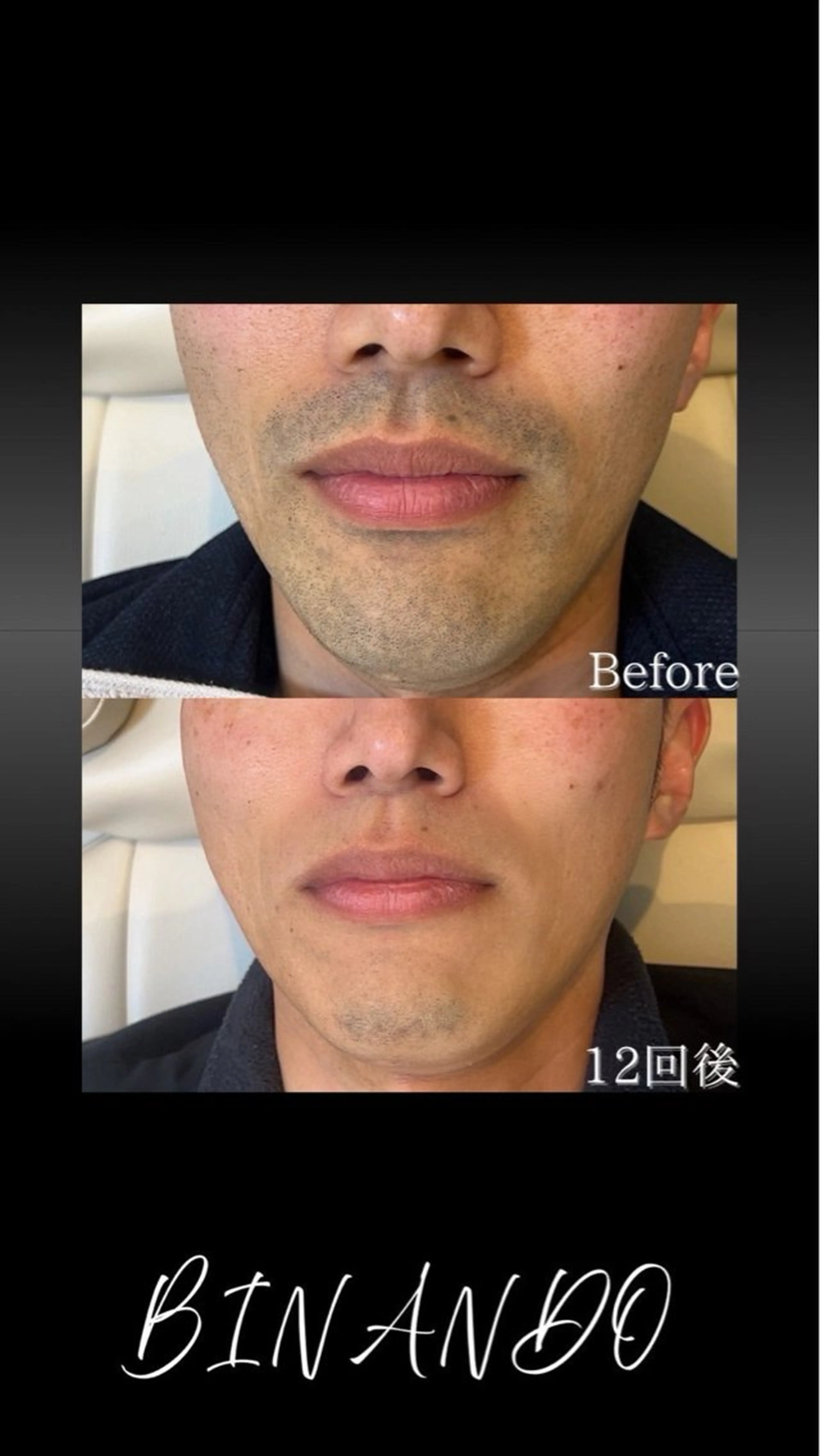 メンズ BINANDO 桑原の眉毛・アイブロウイメージ