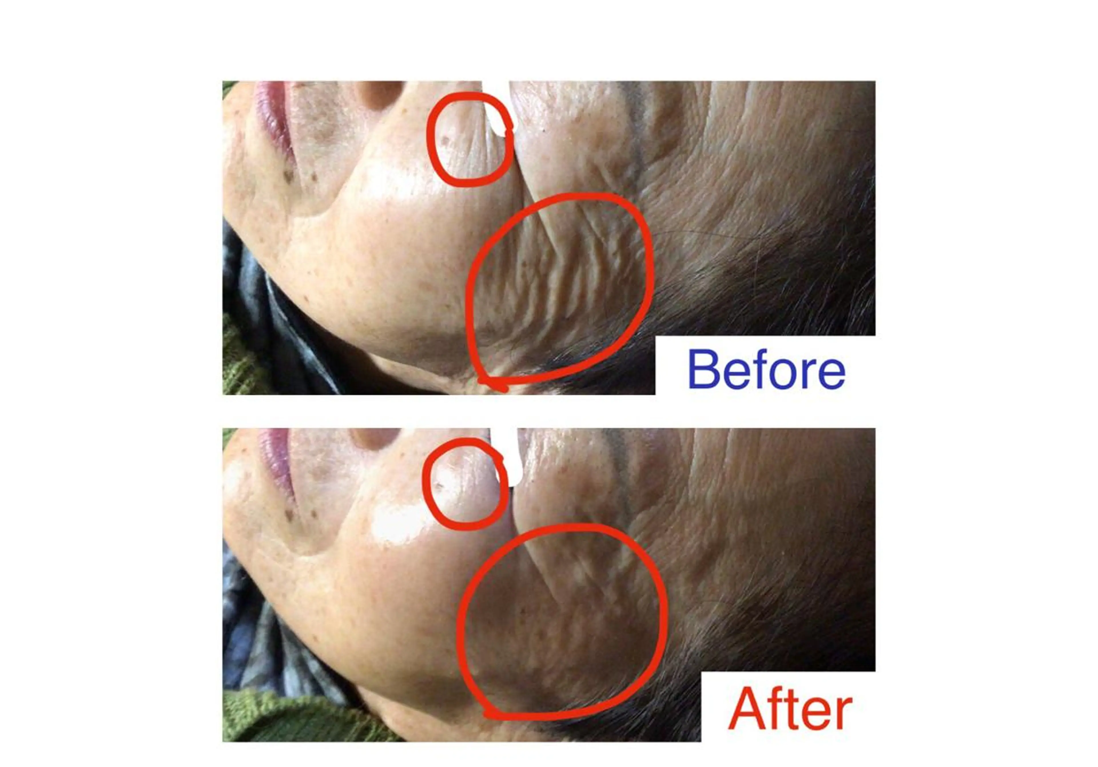 子宮矯正/腸揉み/ シュガーリング脱毛のエステ・リラクイメージ