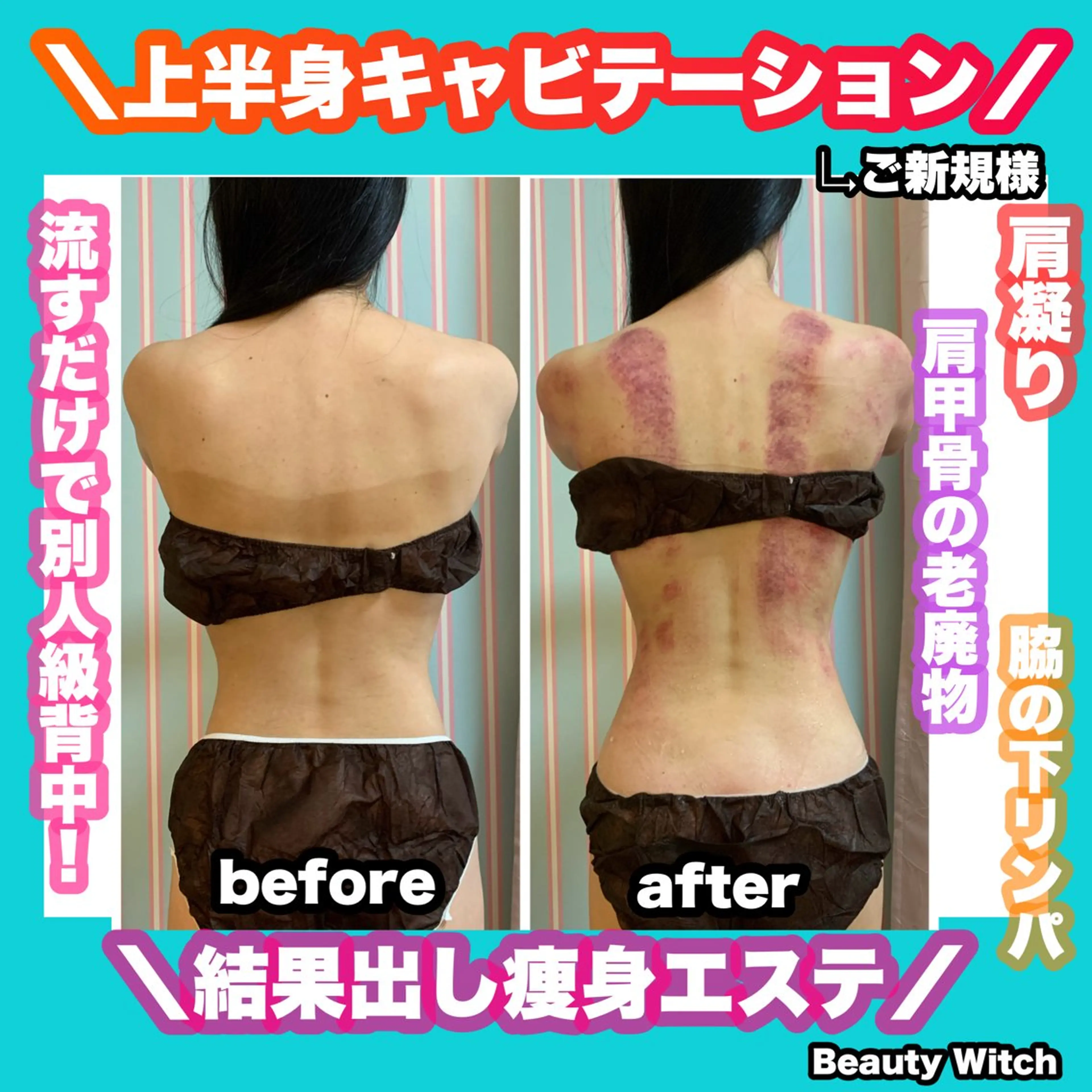 エステ リラク 痩身/脱毛/ネイル HARUKAのエステ・リラクイメージ