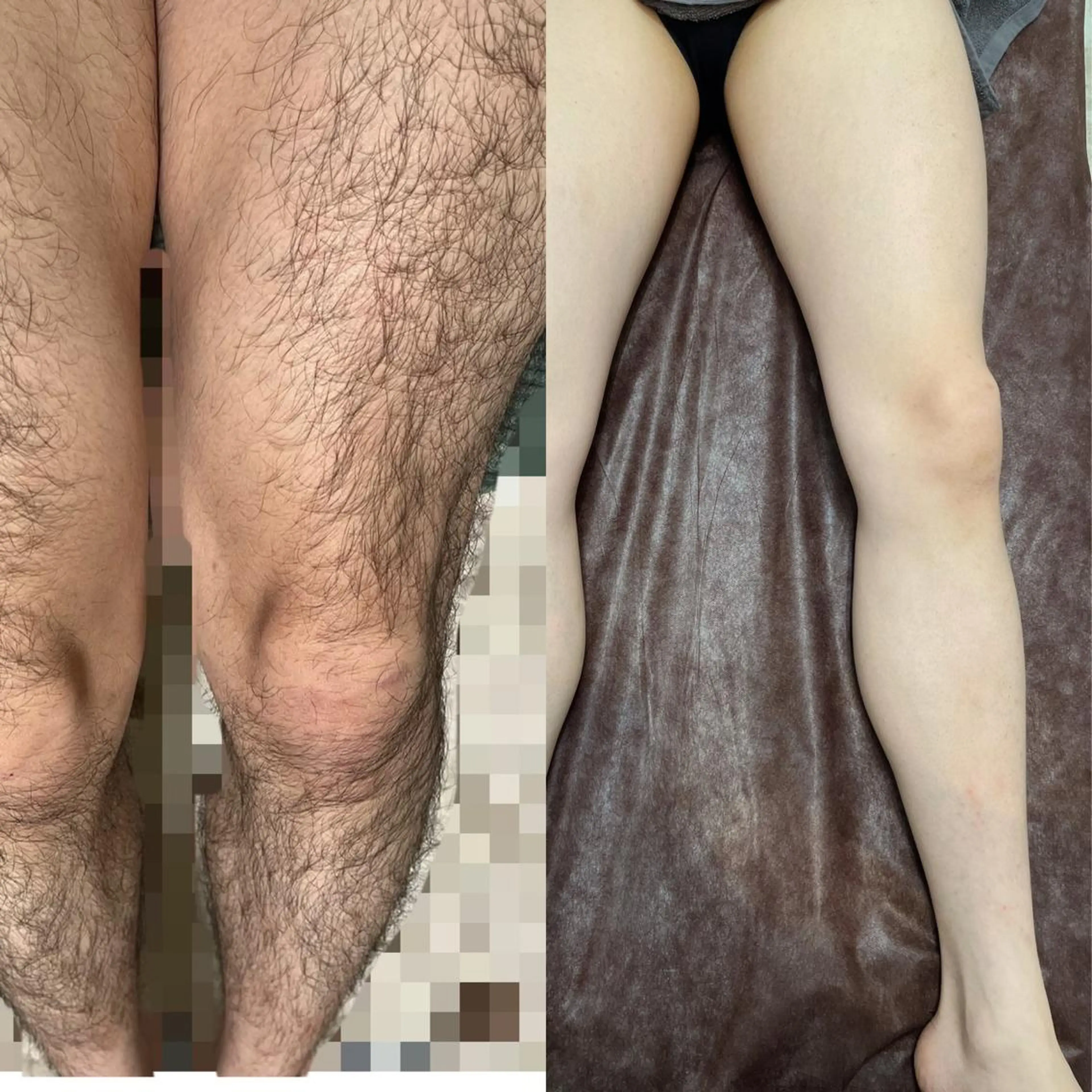 メンズ 脱毛 LUCE メンズ脱毛のエステ・リラクイメージ