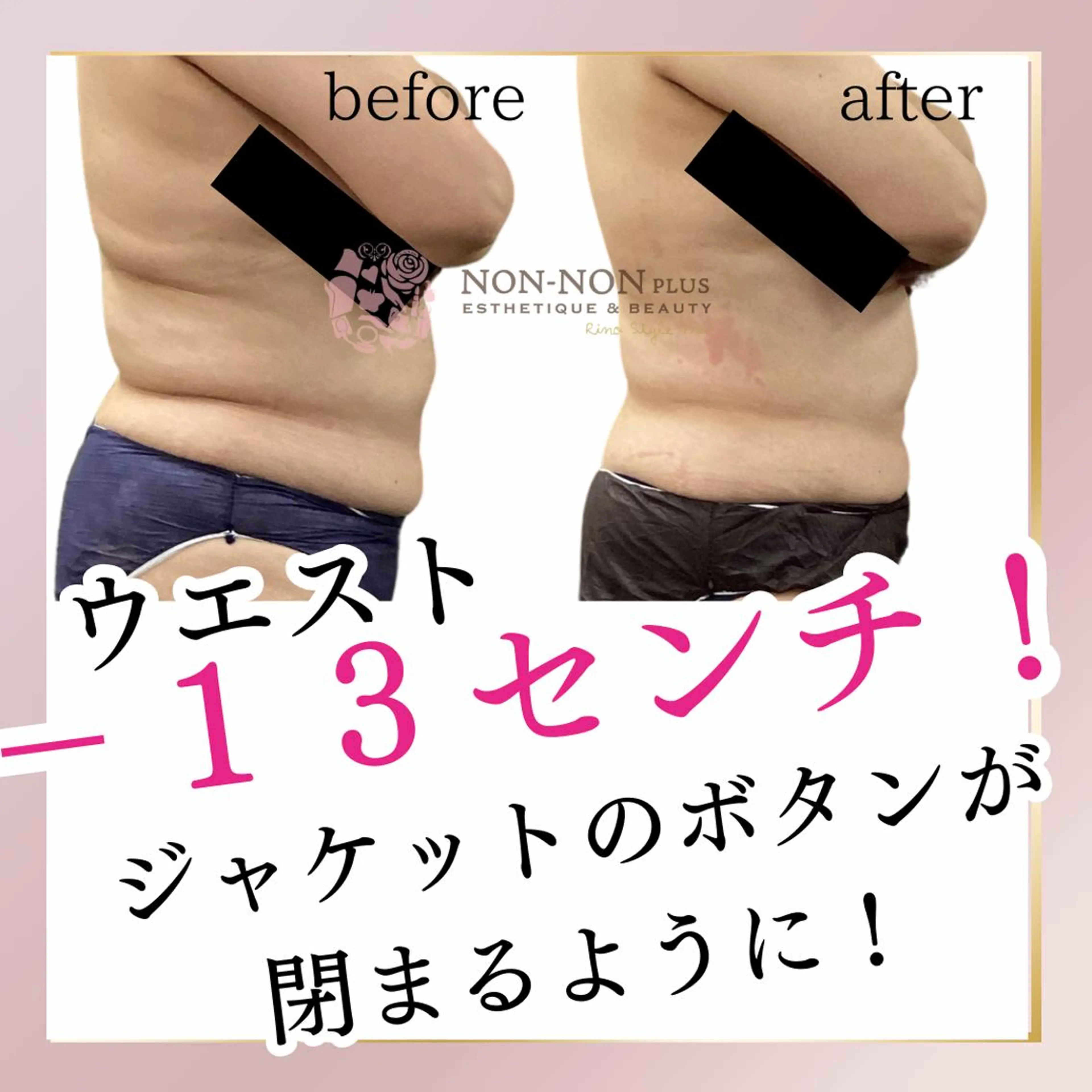 NON-NONプラス 大人の本気痩身のエステ・リラクイメージ