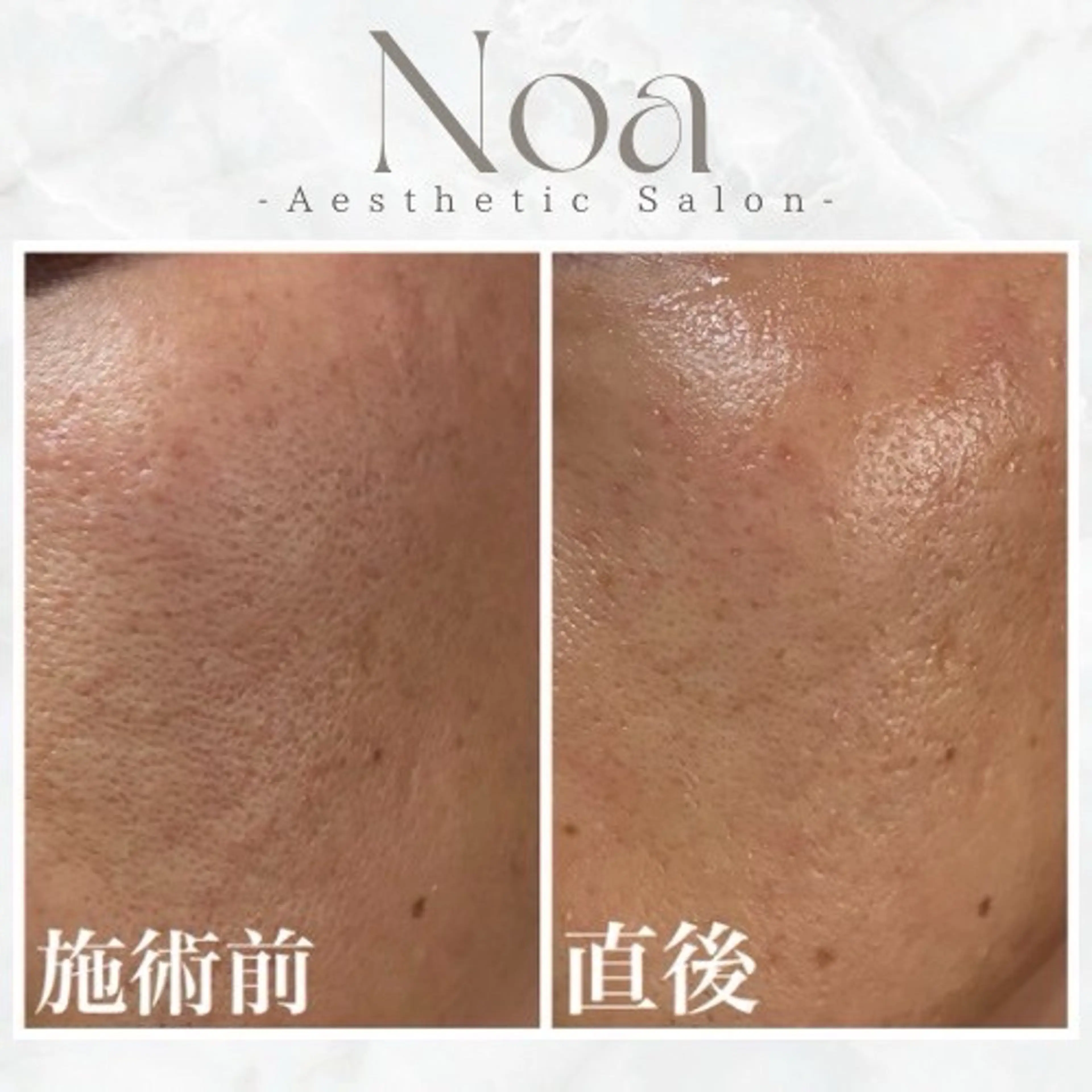 肌質改善サロン Noaのエステ・リラクイメージ