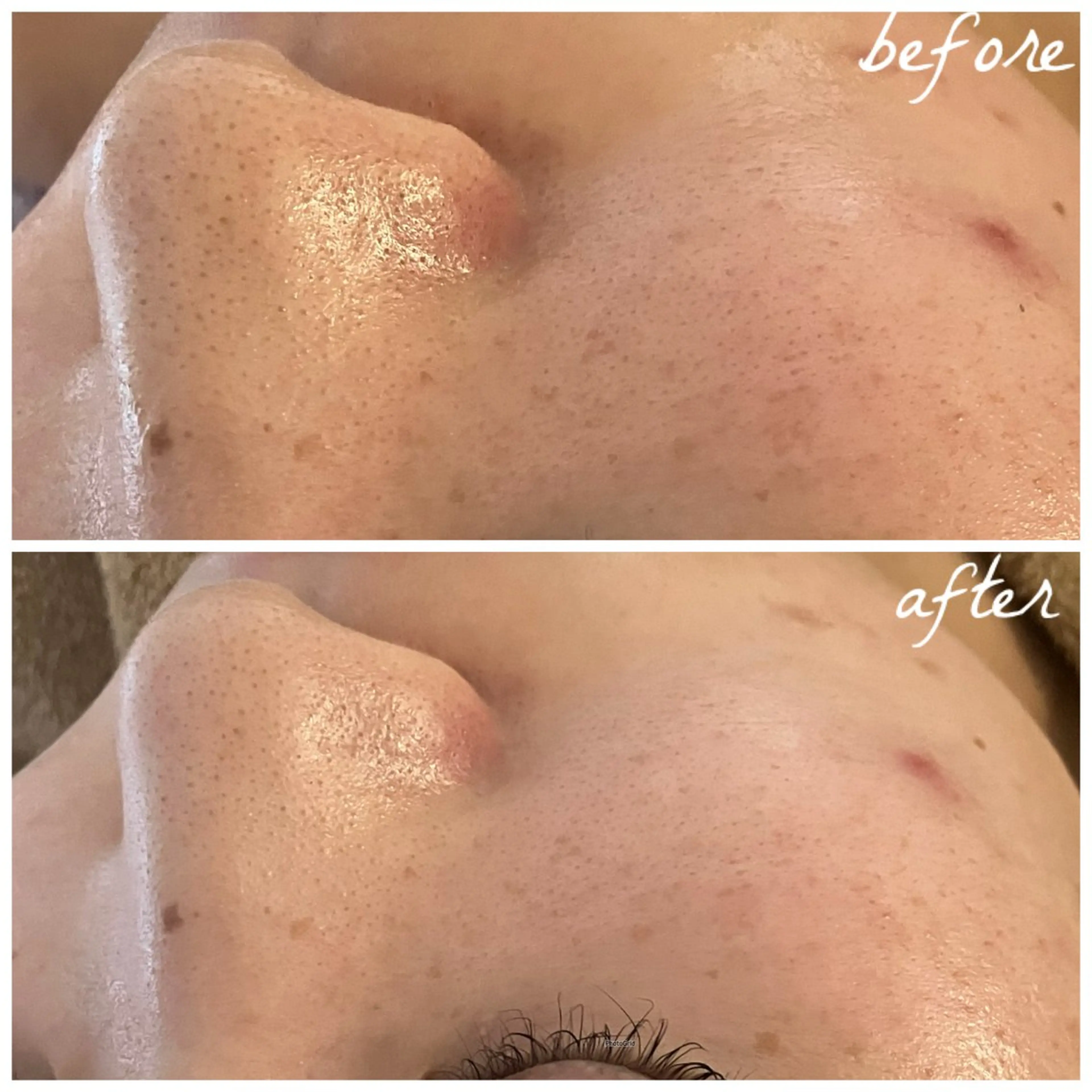 メンズ エステ メナード岐阜茜部 杉浦のエステ・リラクイメージ