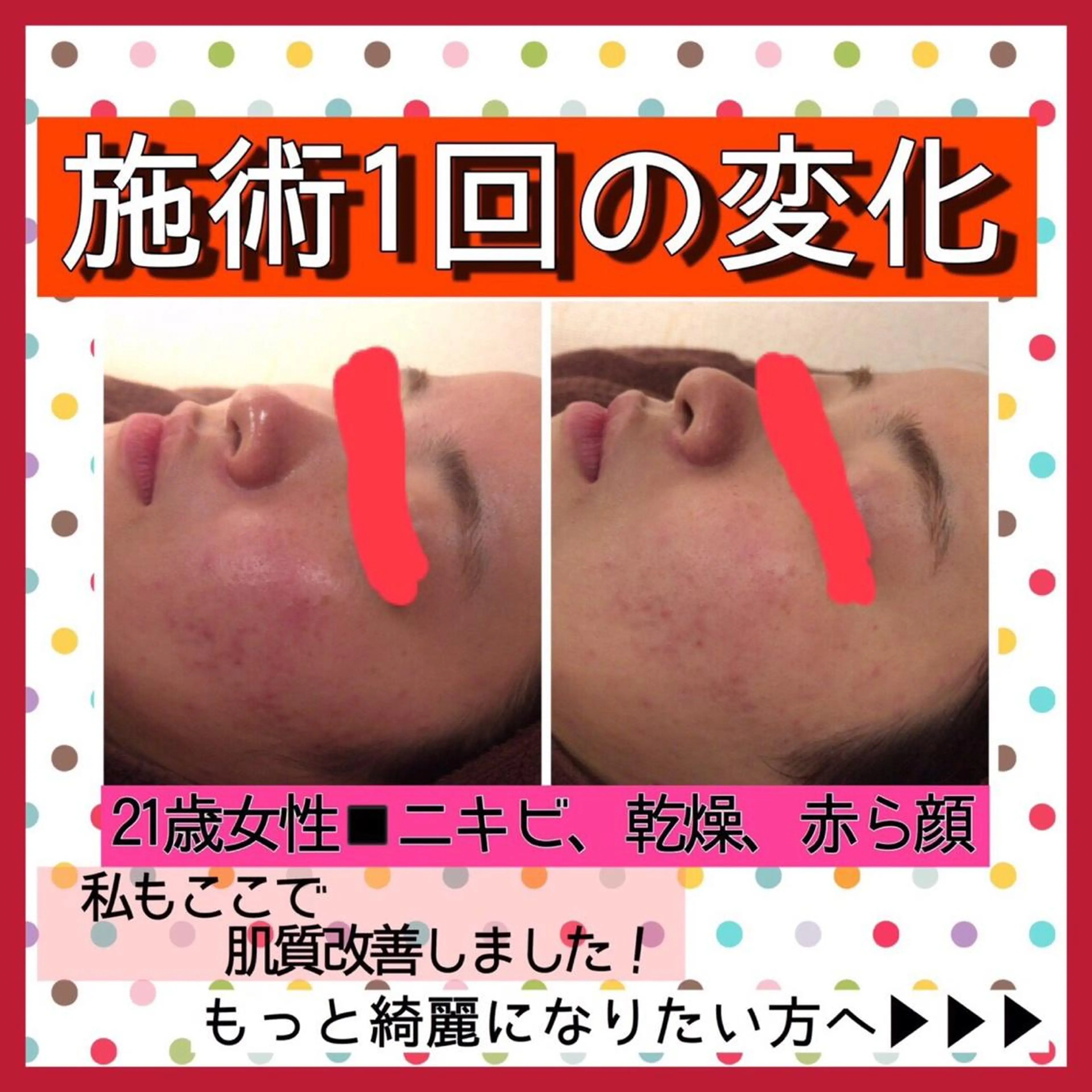 ミディアム カラー パーマ ヘアアレンジ メンズ キッズ ネイル マツエク・マツパ ニキビ・肌質改善専門 ♡人生が変わるサロンのエステ・リラクイメージ