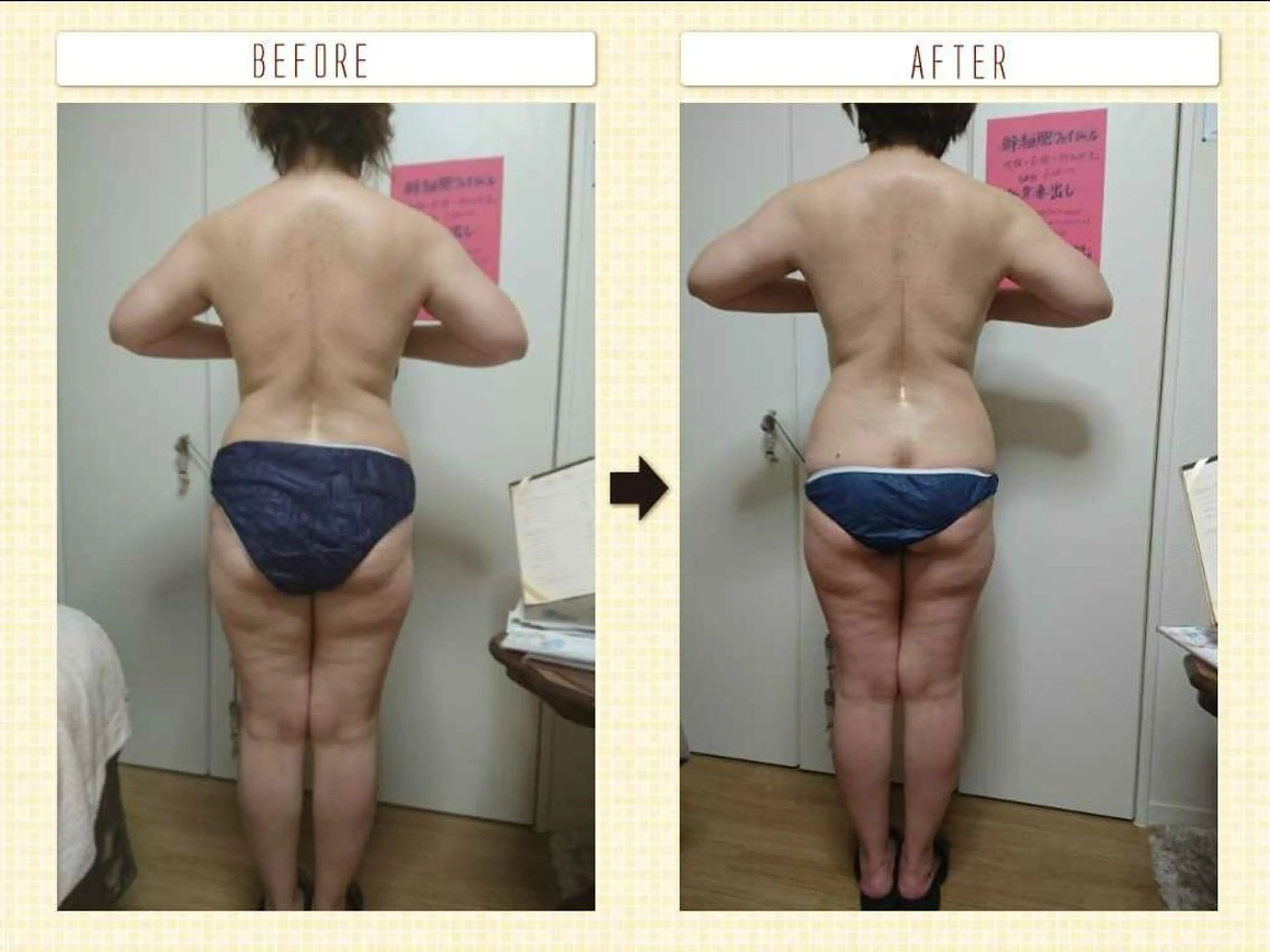 Arebeau 健康的にダイエットのエステ・リラクイメージ