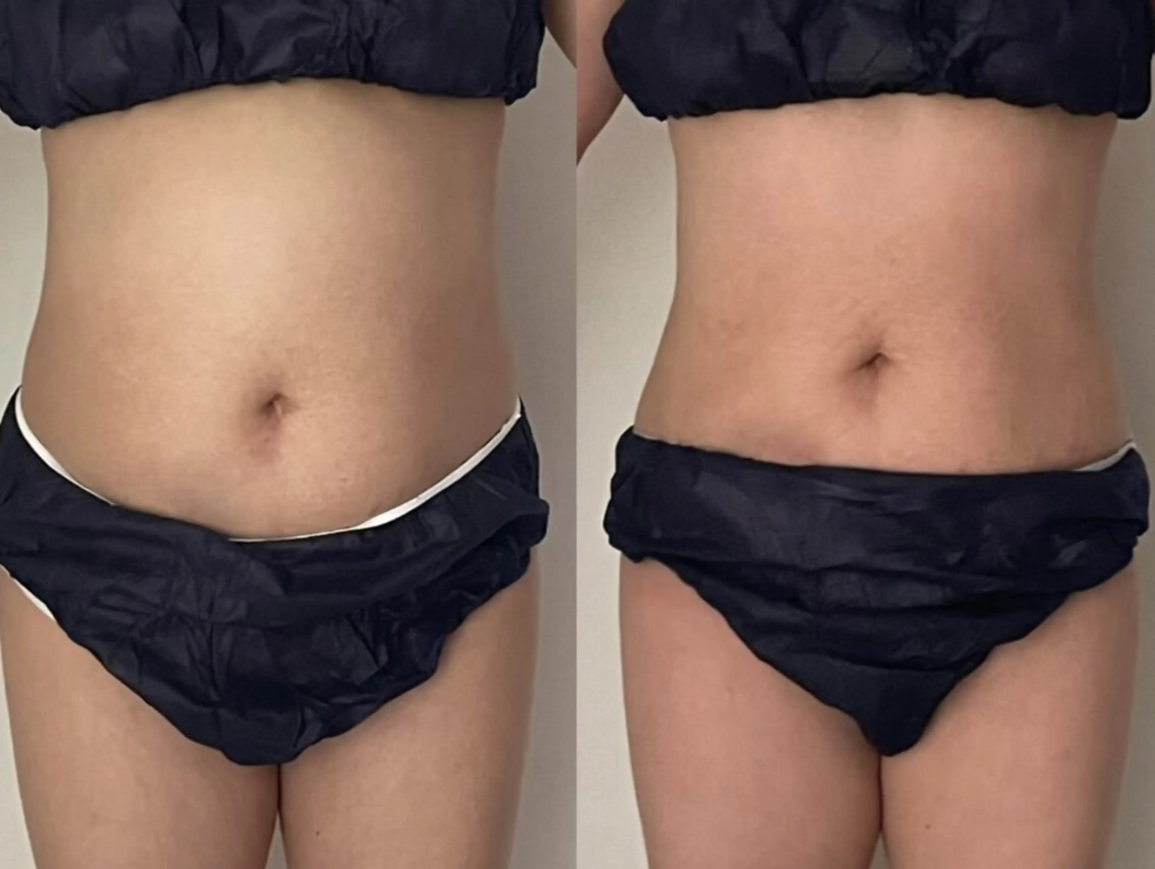 【人気No.１】〈むくみ・冷え解消〉徹底サイズダウンの写真