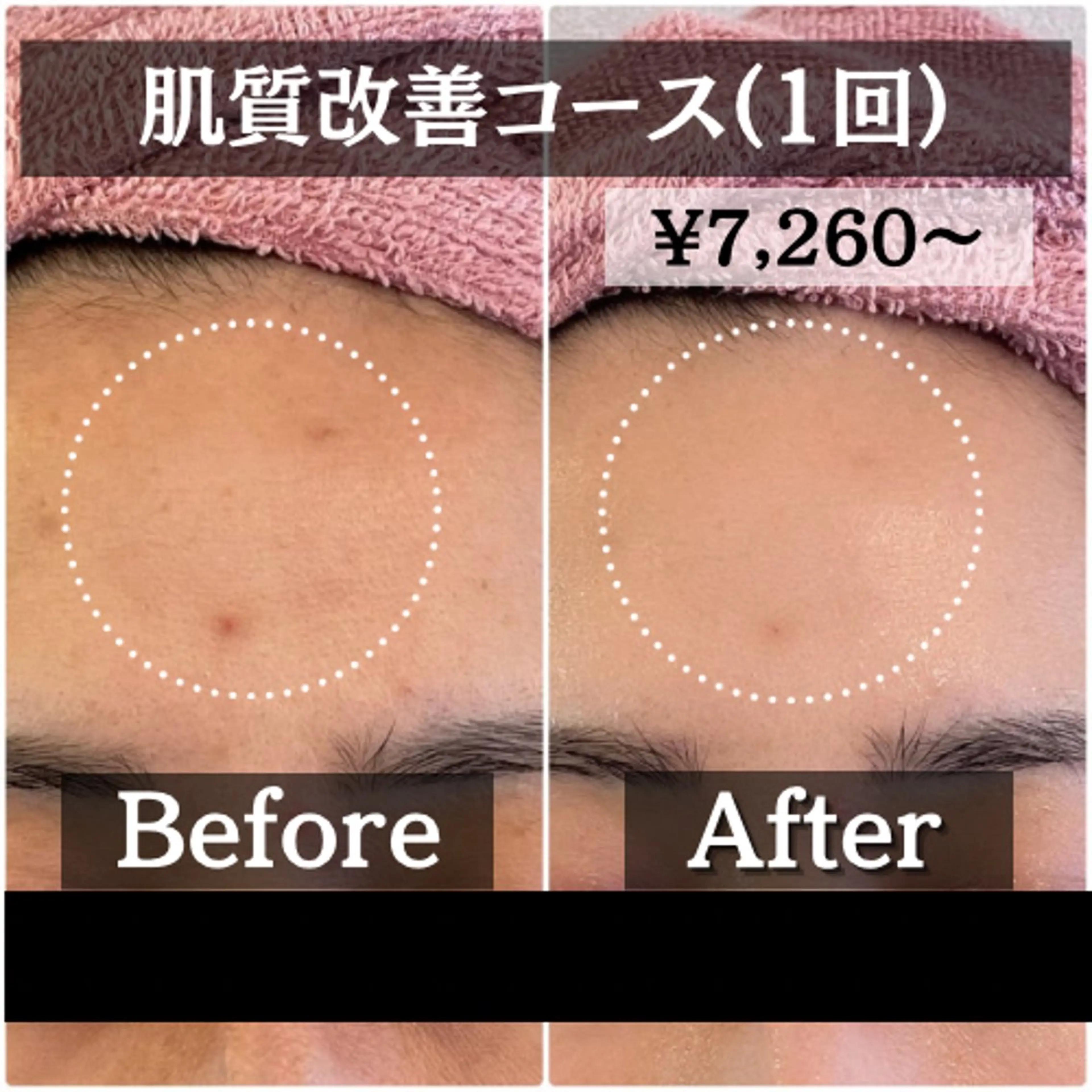 エステ リラク 【肌質改善・リフトアップ専門店】セラピックエステ美極所属・羽賀 茉衣子のエステ・リラクイメージ