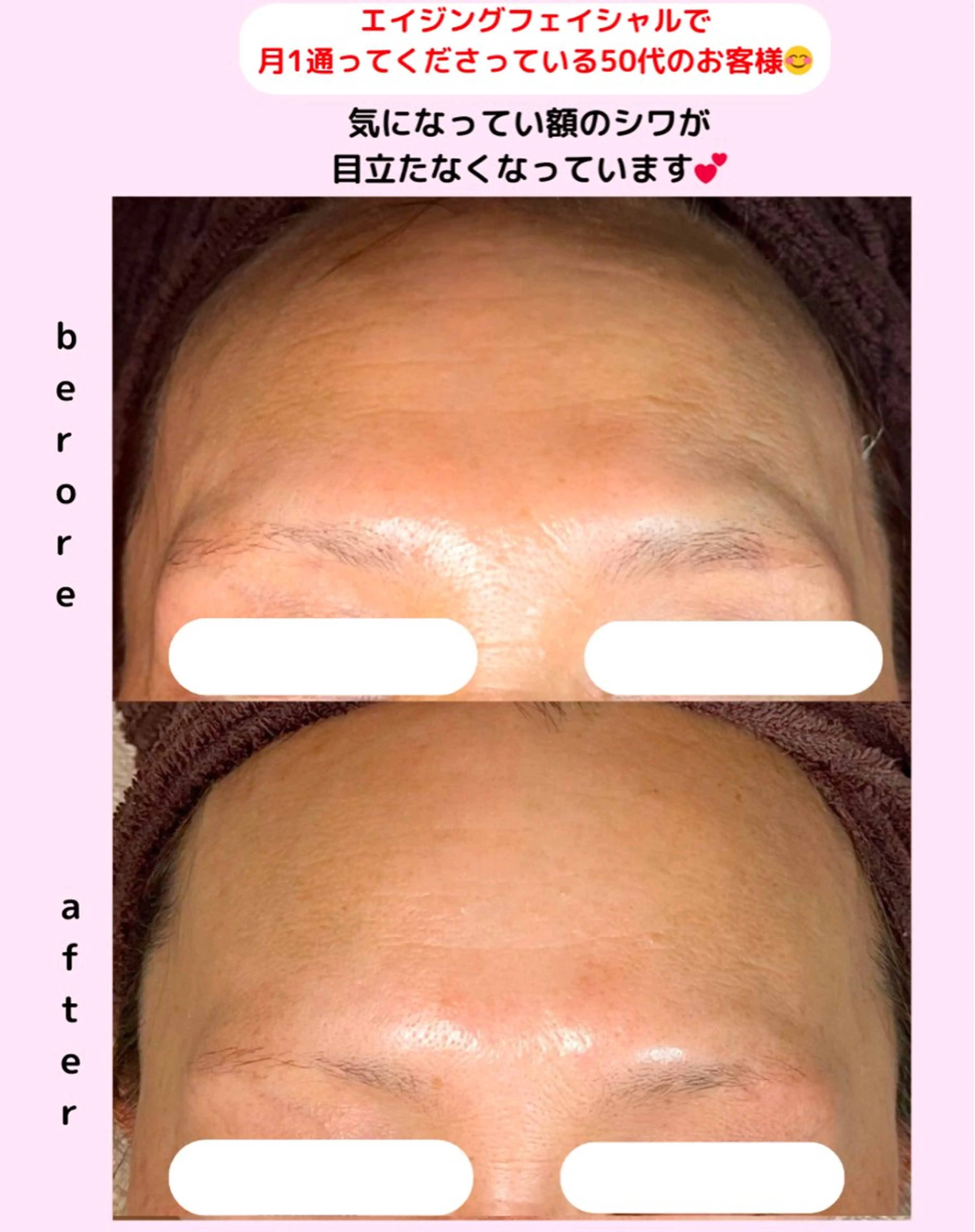 ベラージュ【美背中・ 美尻・フェイシャル】のエステ・リラクイメージ