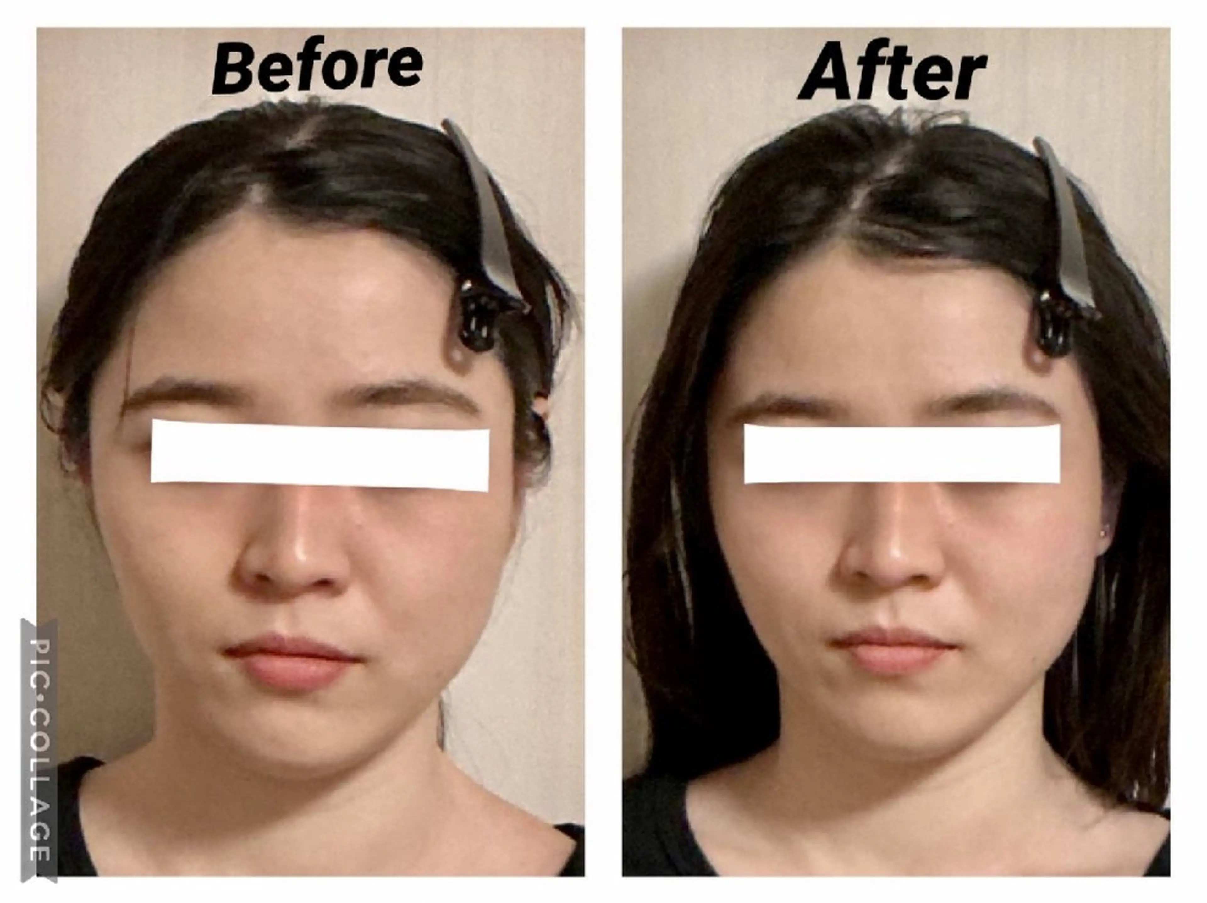 エステ リラク 小顔矯正Sho  FaceDesignのエステ・リラクイメージ