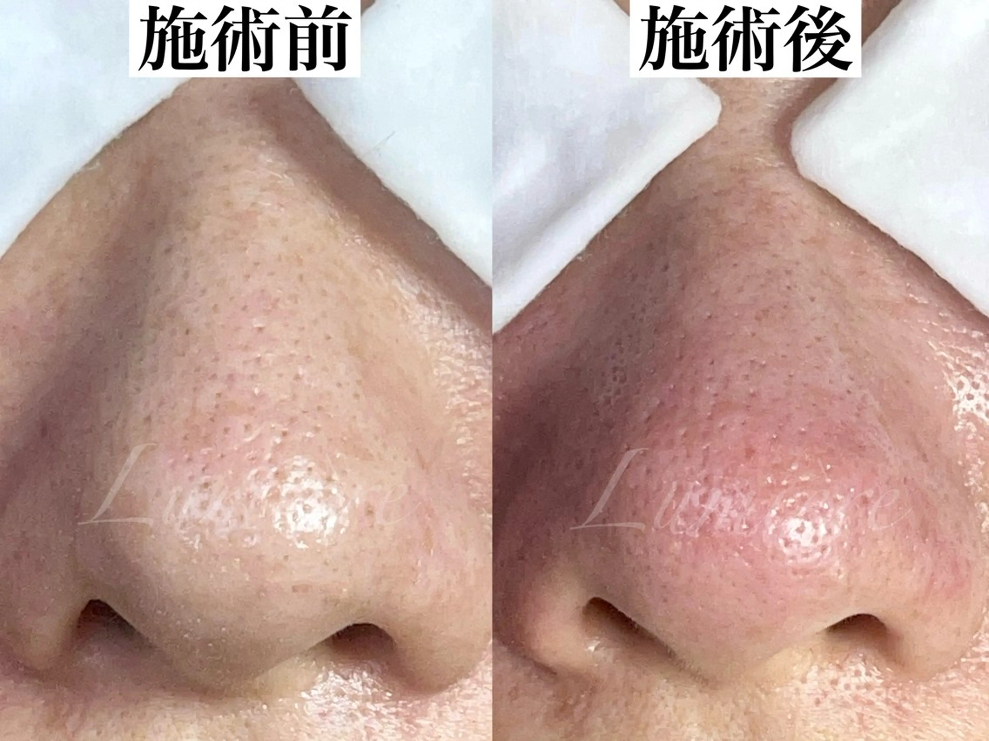 エステ マツヤニワックス専門 堂山町 ルミエールのエステ・リラクイメージ